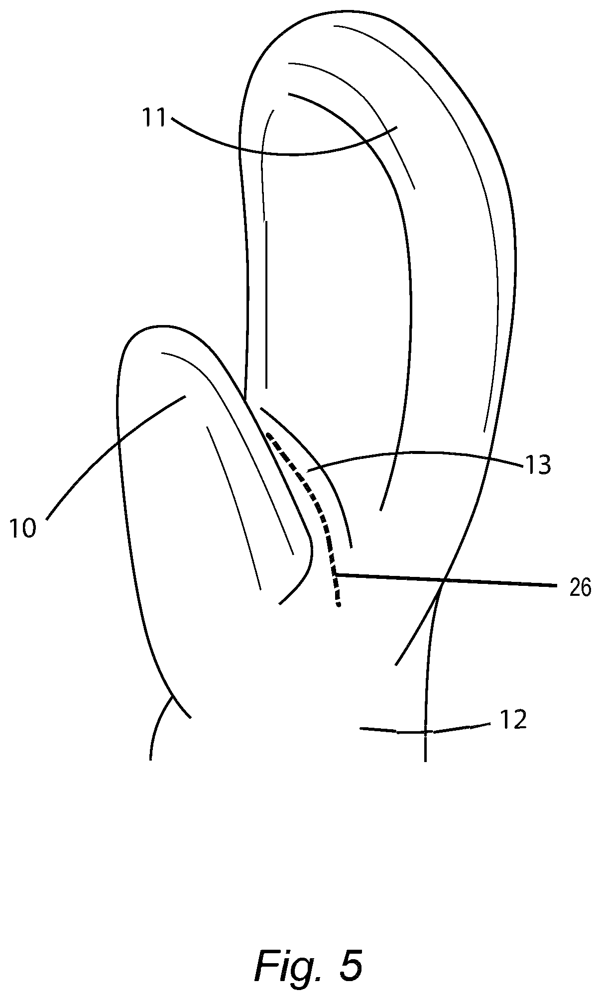 Patent US12564761 Figure 5 – Device for facial and neck muscles stimulation