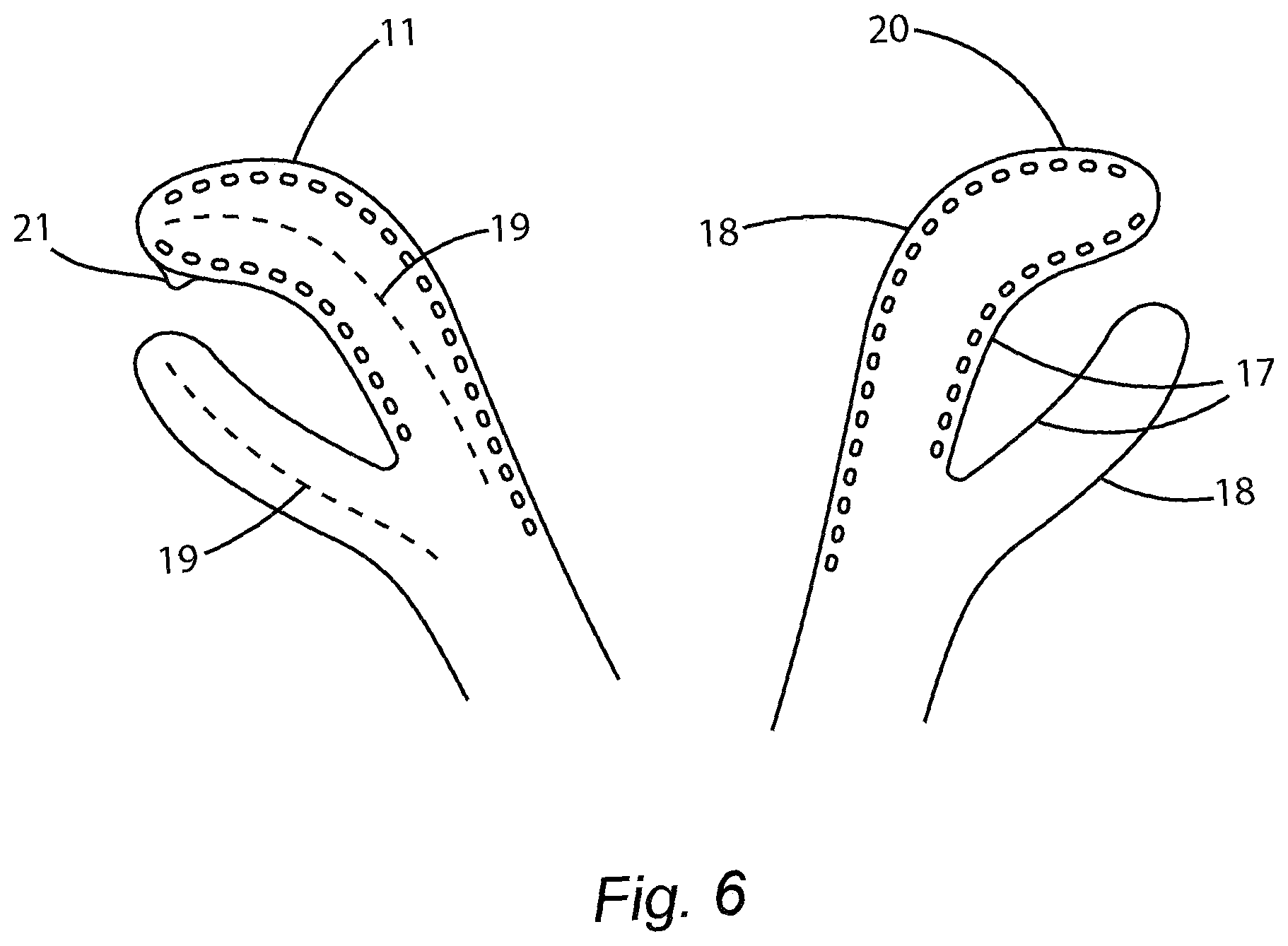Patent US12564761 Figure 6 – Device for facial and neck muscles stimulation