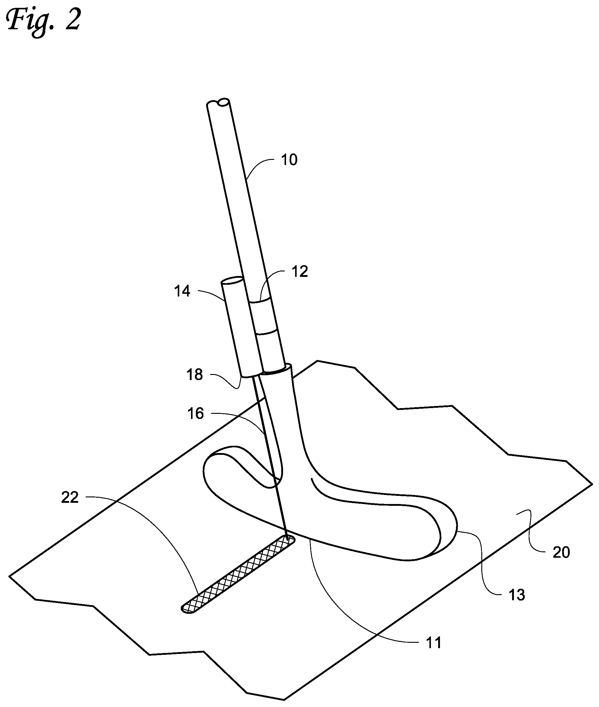 Patent US12564774 Figure 2 – Golf training system and methods