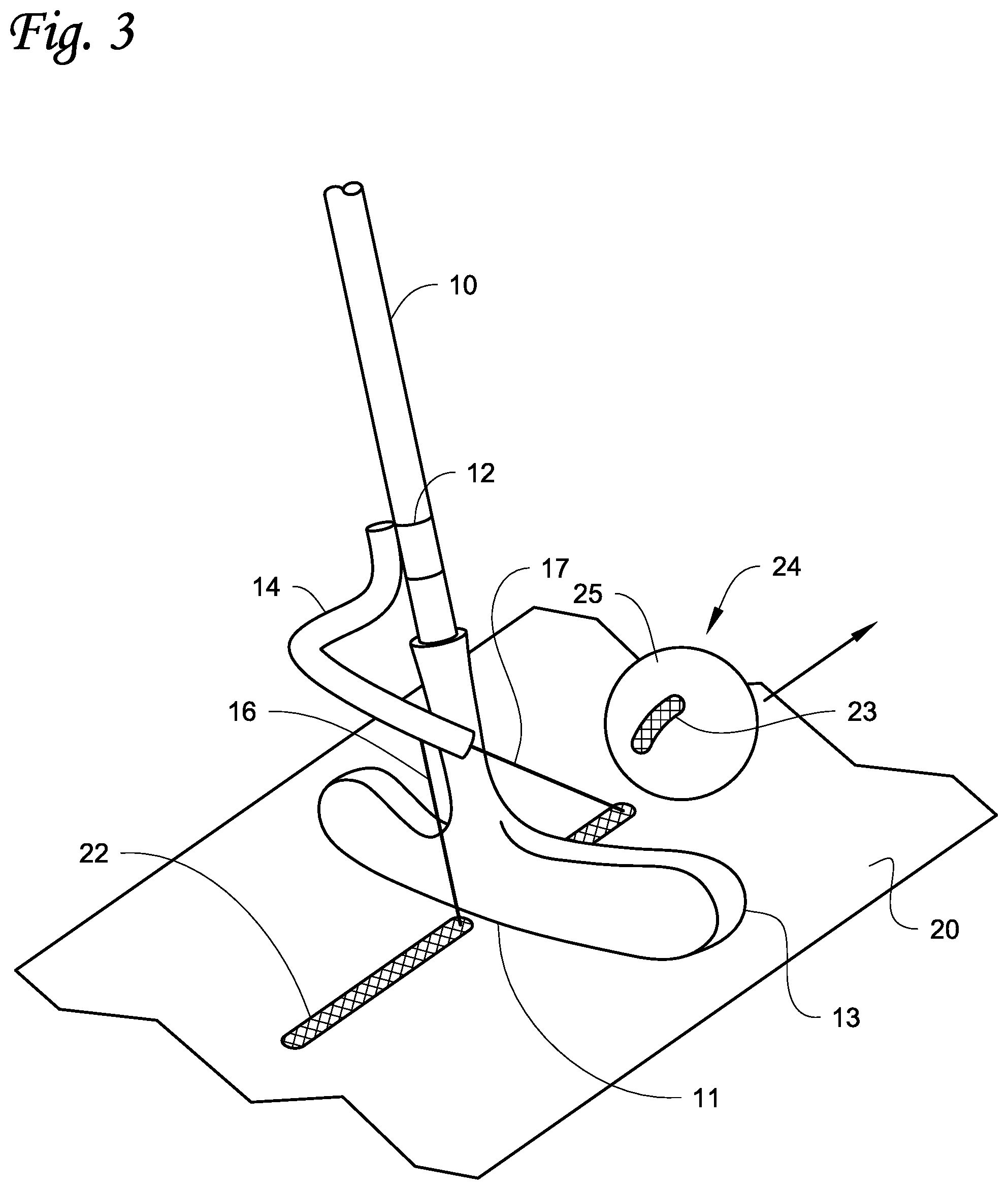 Patent US12564774 Figure 3 – Golf training system and methods