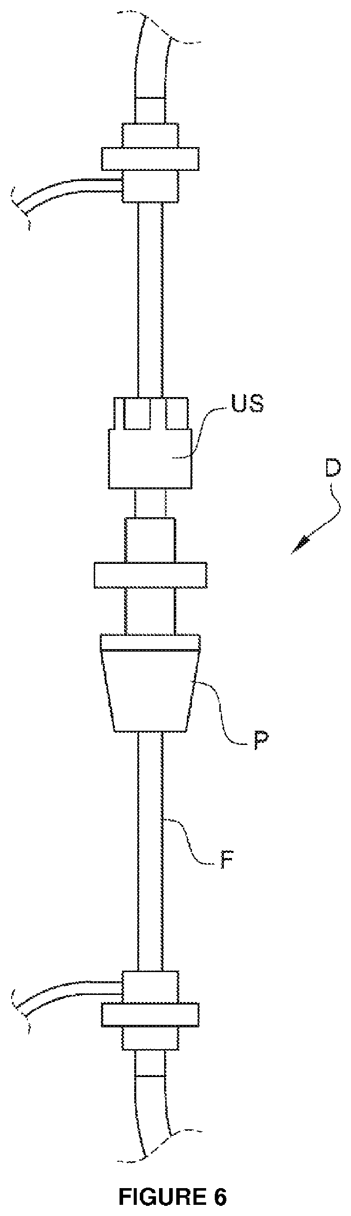 Patent US12564815 Figure 5 – Liquid filtration device comprising an ultrasound emission module
