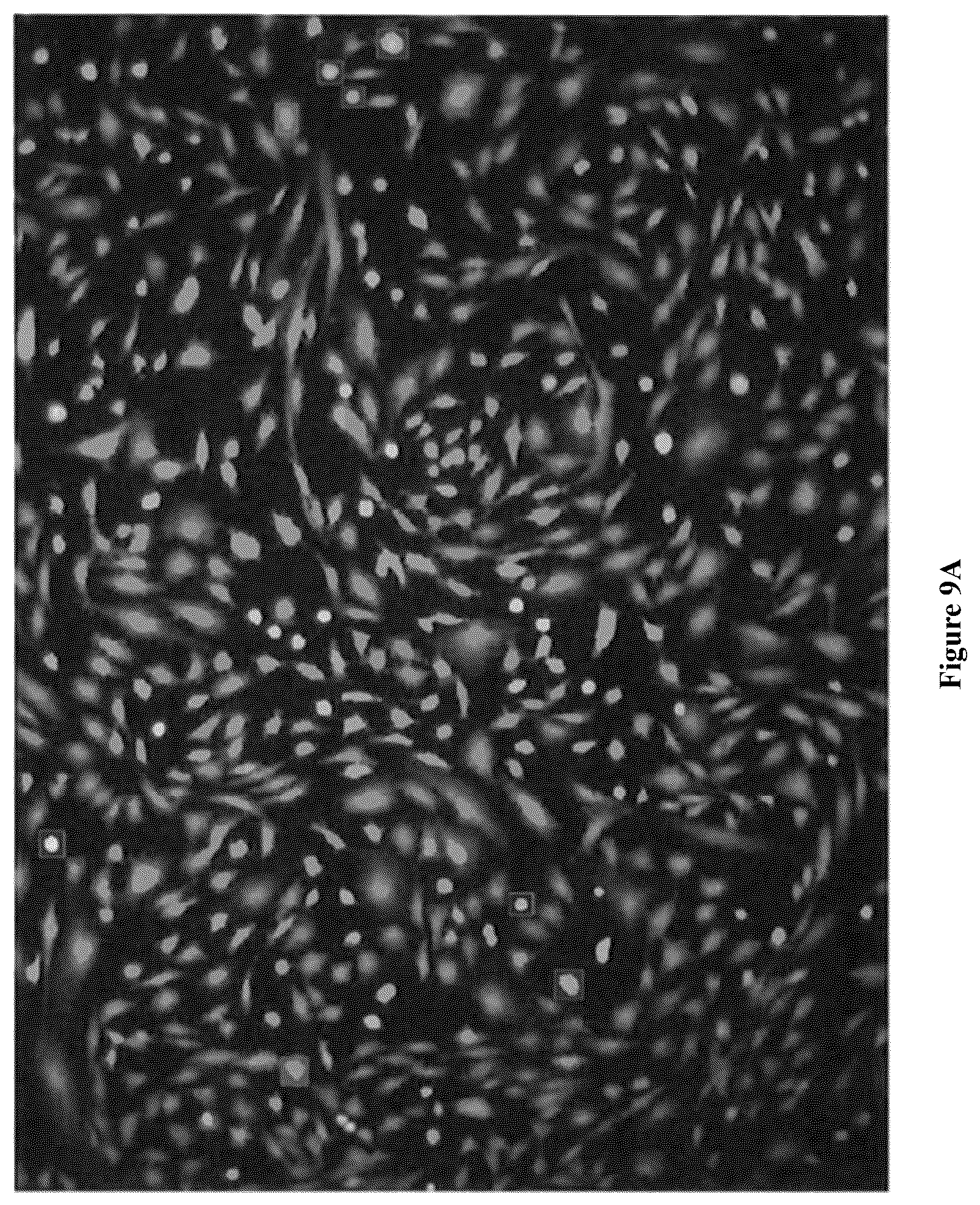 Patent US12564822 Figure 11 – Device for manufacture of T-cells for autologous cell therapy