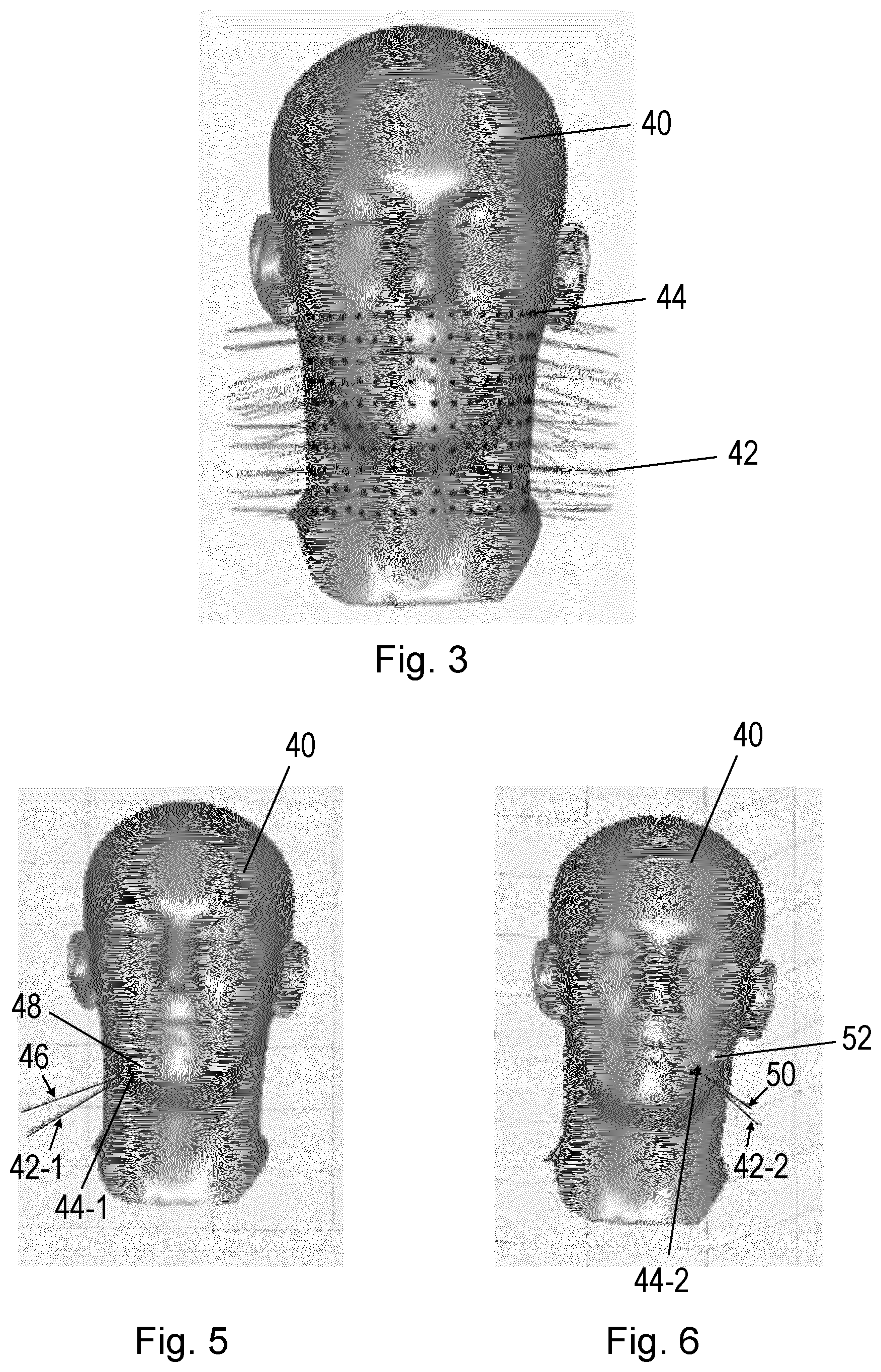 Patent US12564975 Figure 3 – Determining a device location on a body part