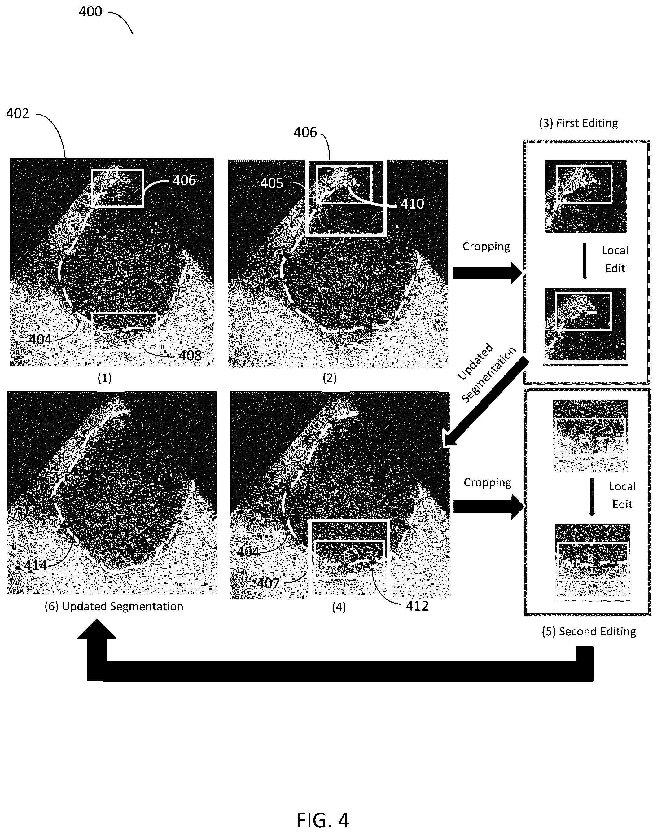 Patent US12567150 Figure 4 – Editing presegmented images and volumes using deep learning