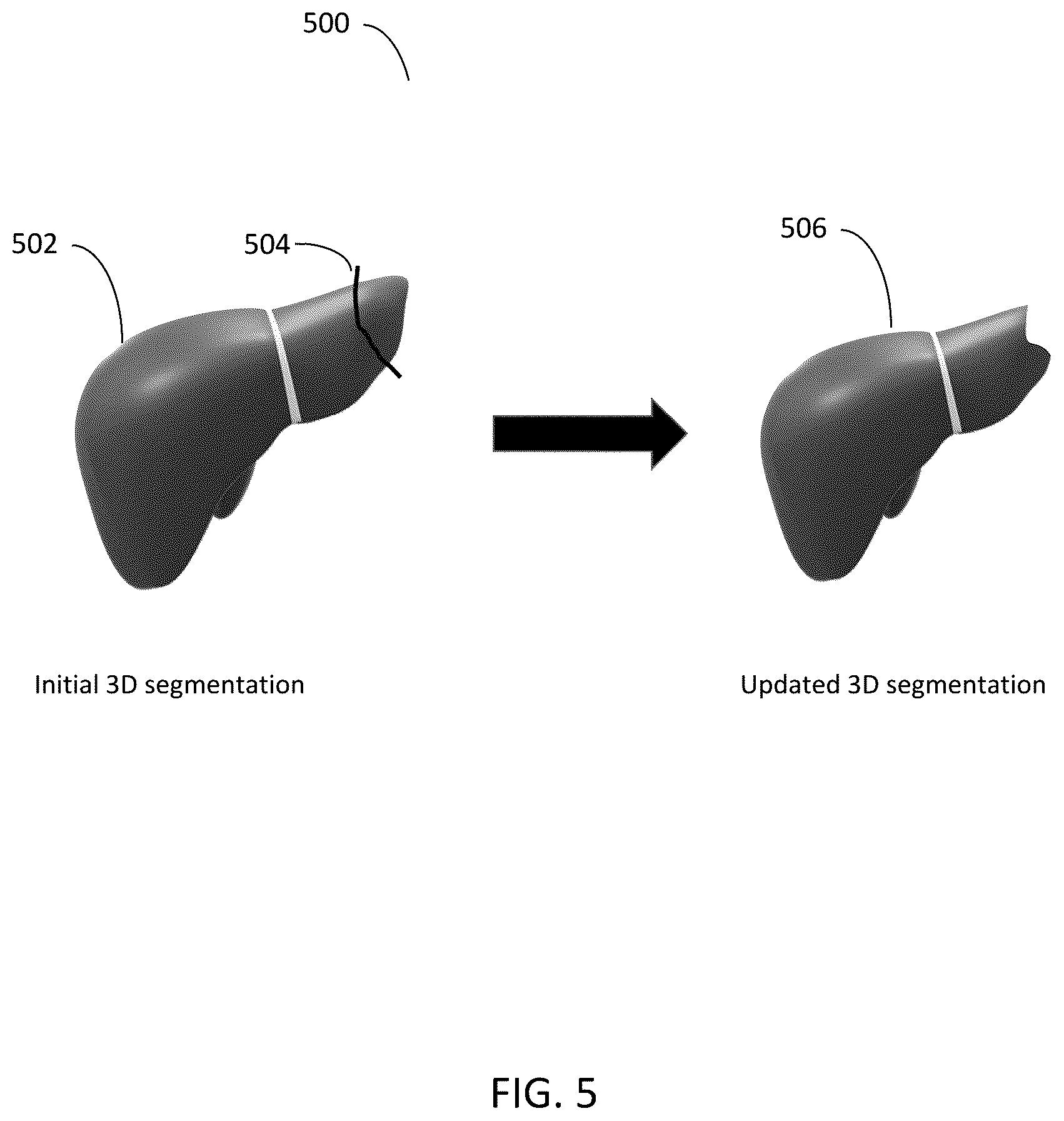 Patent US12567150 Figure 5 – Editing presegmented images and volumes using deep learning