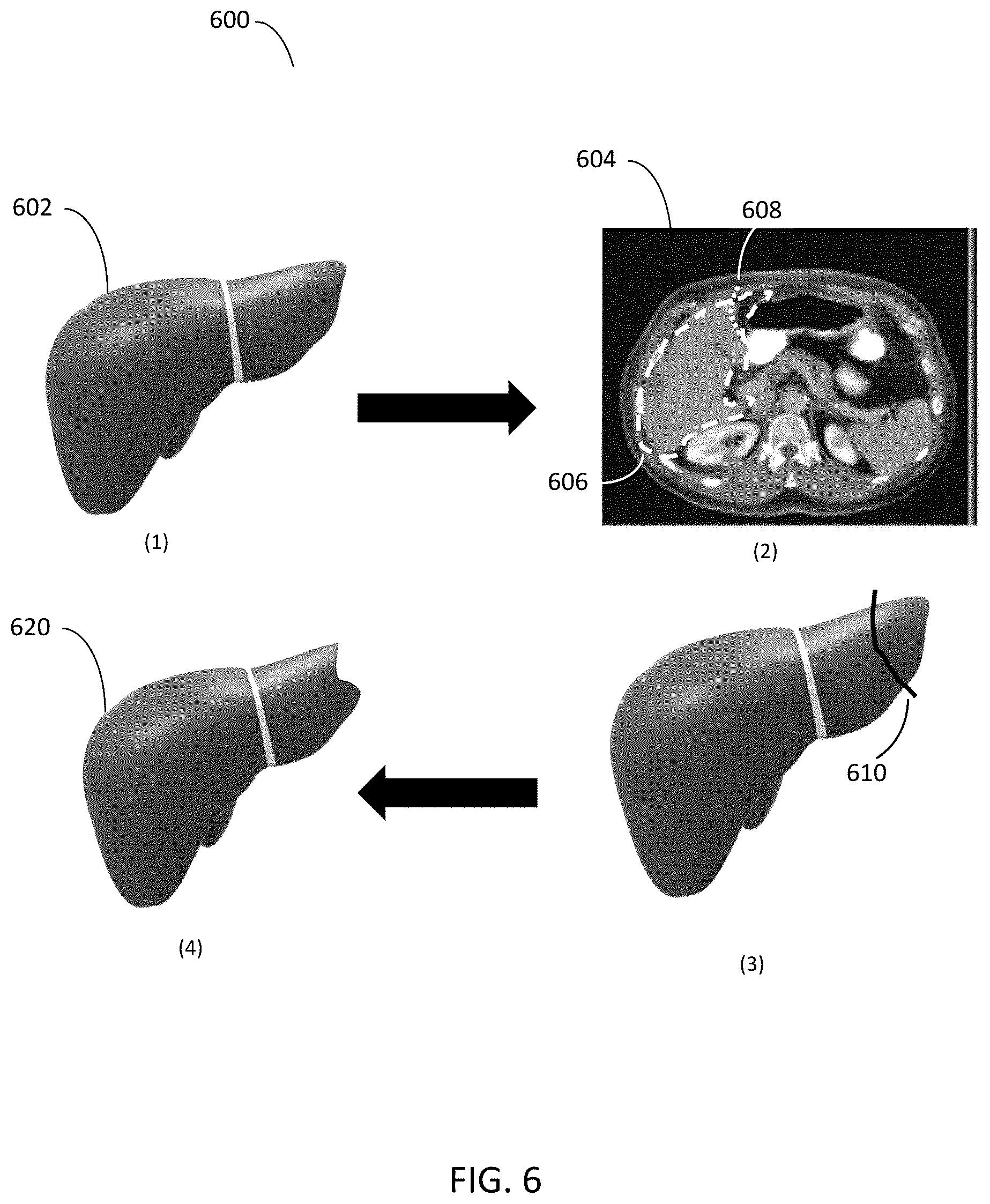 Patent US12567150 Figure 6 – Editing presegmented images and volumes using deep learning