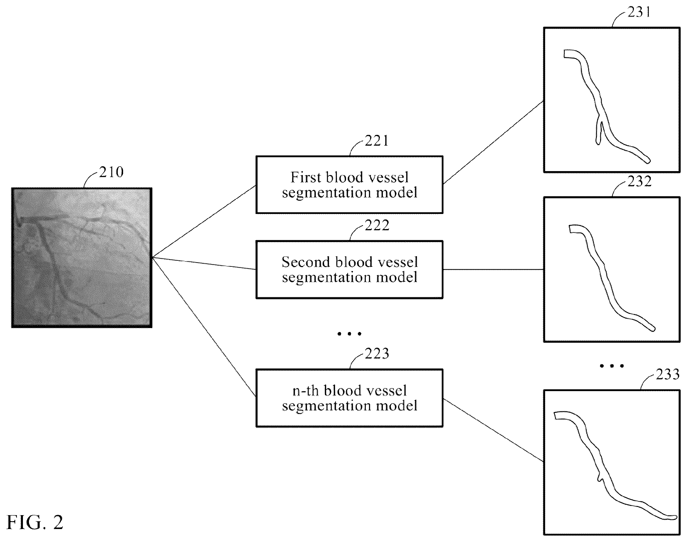 Patent US12567152 Figure 2 – Blood vessel image segmenting method and apparatus using plurality of prediction results