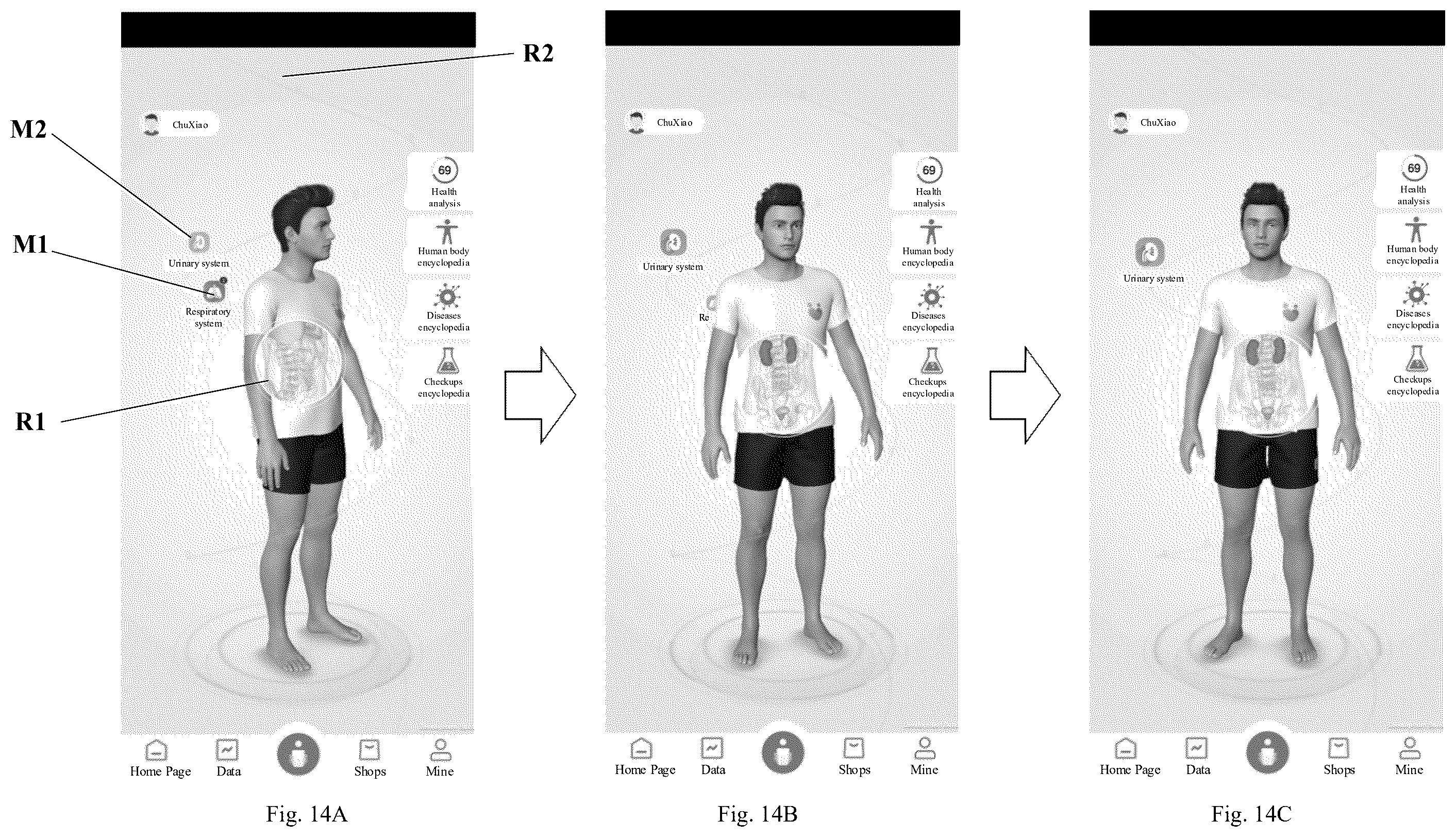 Patent US12567211 Figure 9 – Health management system, and human body information display method and human body model generation method applied to same