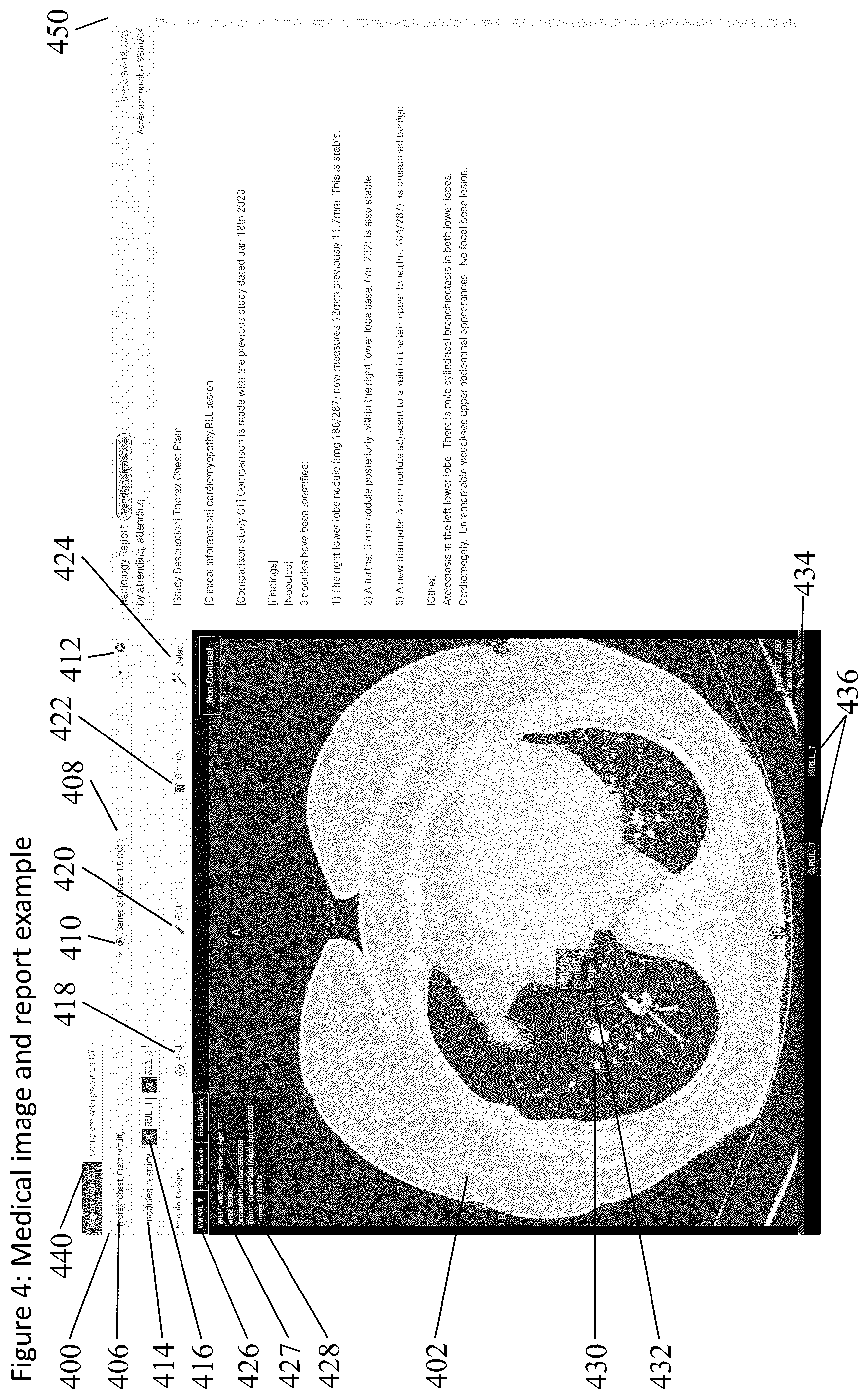 Patent US12567496 Figure 5 – Method and apparatus for displaying and analyzing medical scan images