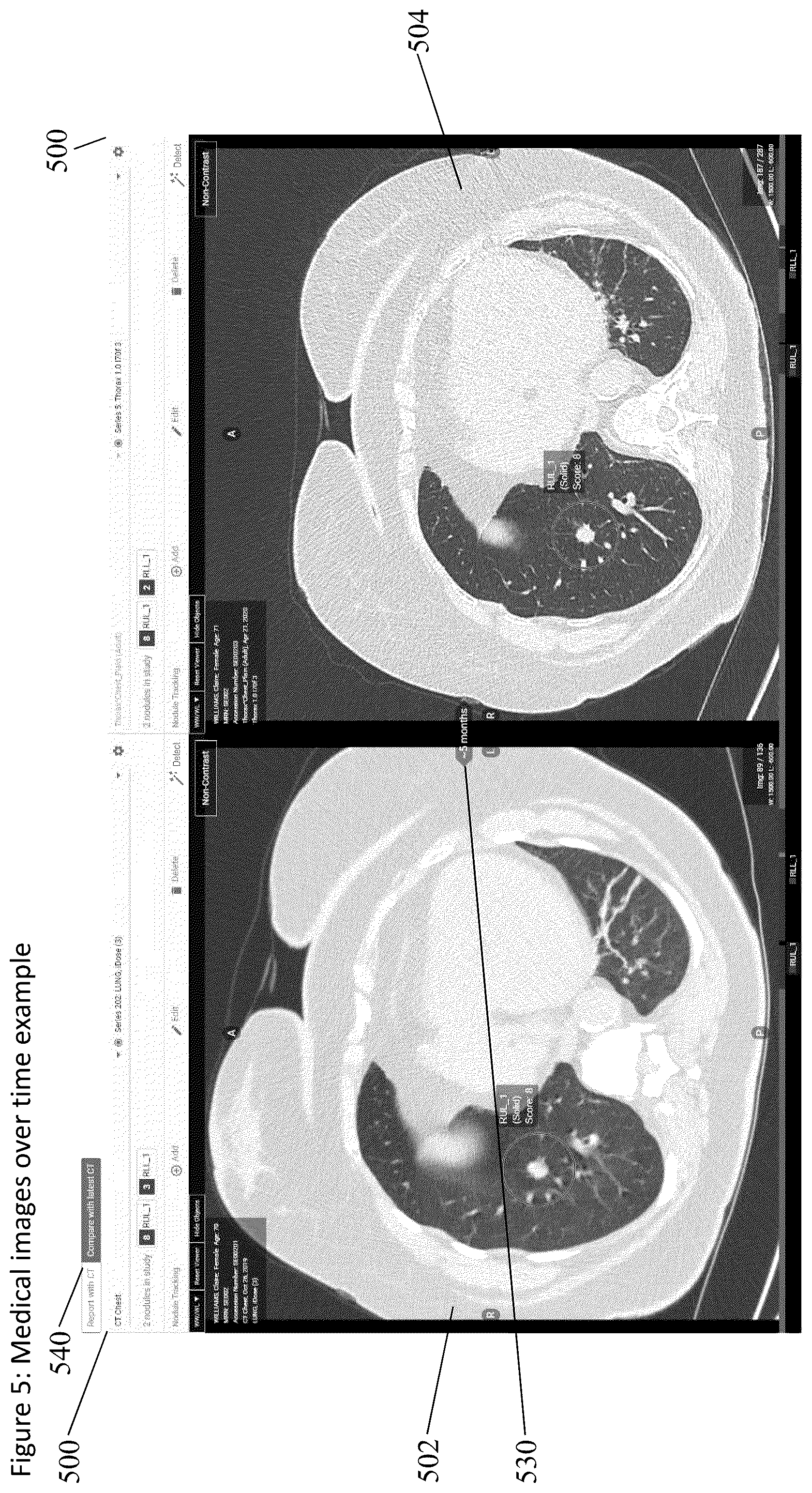 Patent US12567496 Figure 6 – Method and apparatus for displaying and analyzing medical scan images