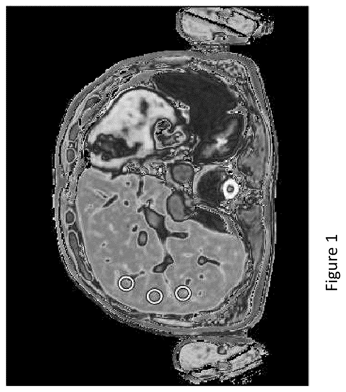 Patent US12567497 Figure 1 – Method of analysing medical images