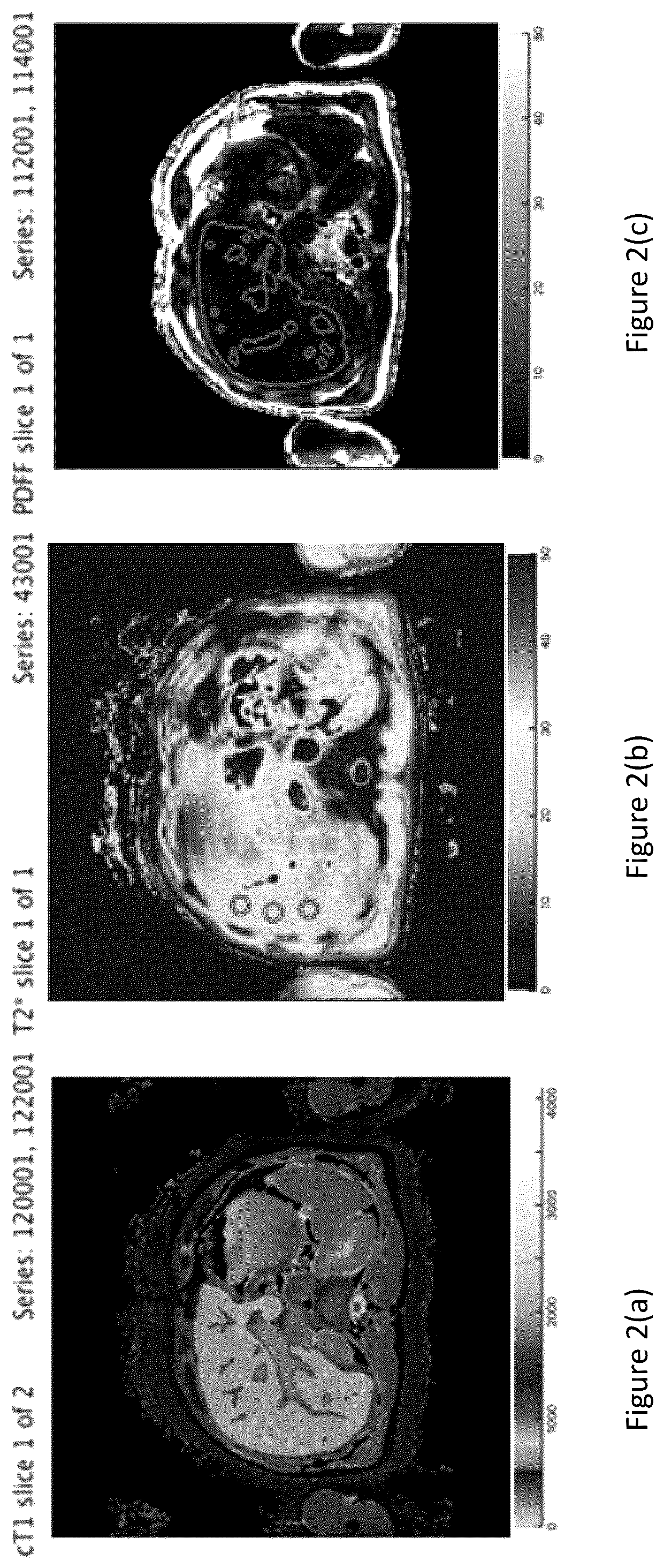 Patent US12567497 Figure 2 – Method of analysing medical images