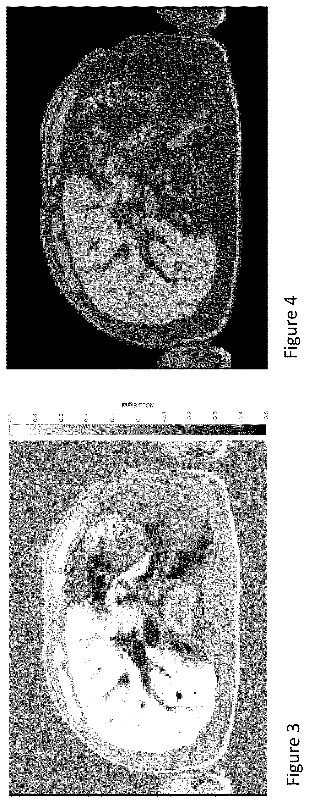 Patent US12567497 Figure 3 – Method of analysing medical images