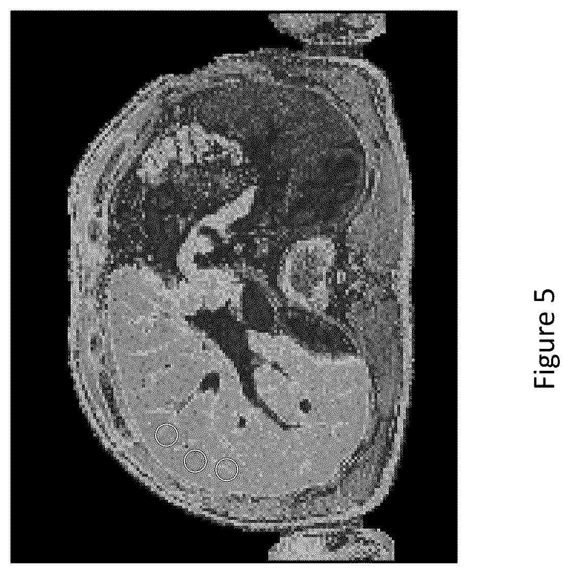 Patent US12567497 Figure 4 – Method of analysing medical images
