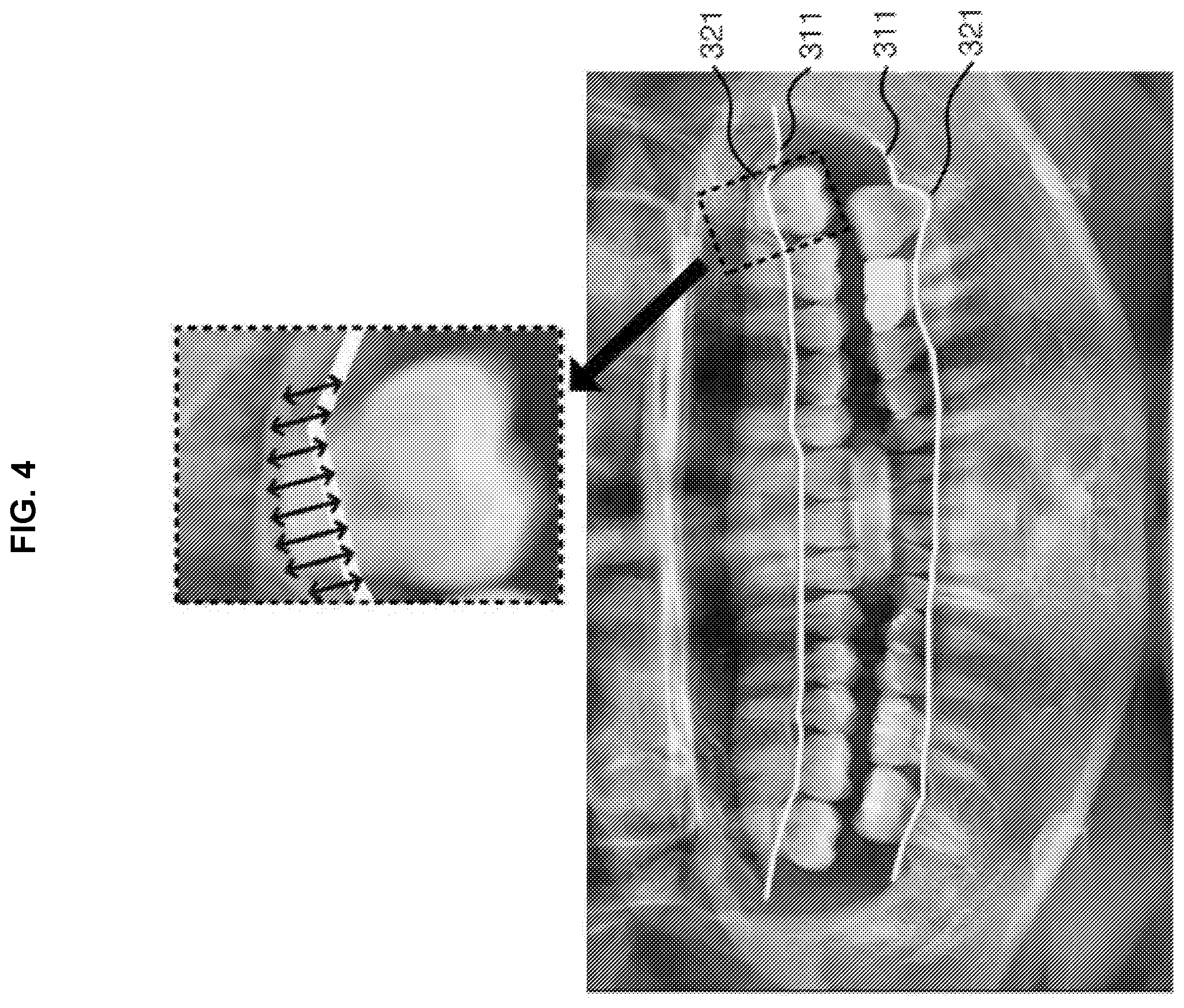 Patent US12567499 Figure 5 – Method and terminal device for providing oral state information including periodontitis