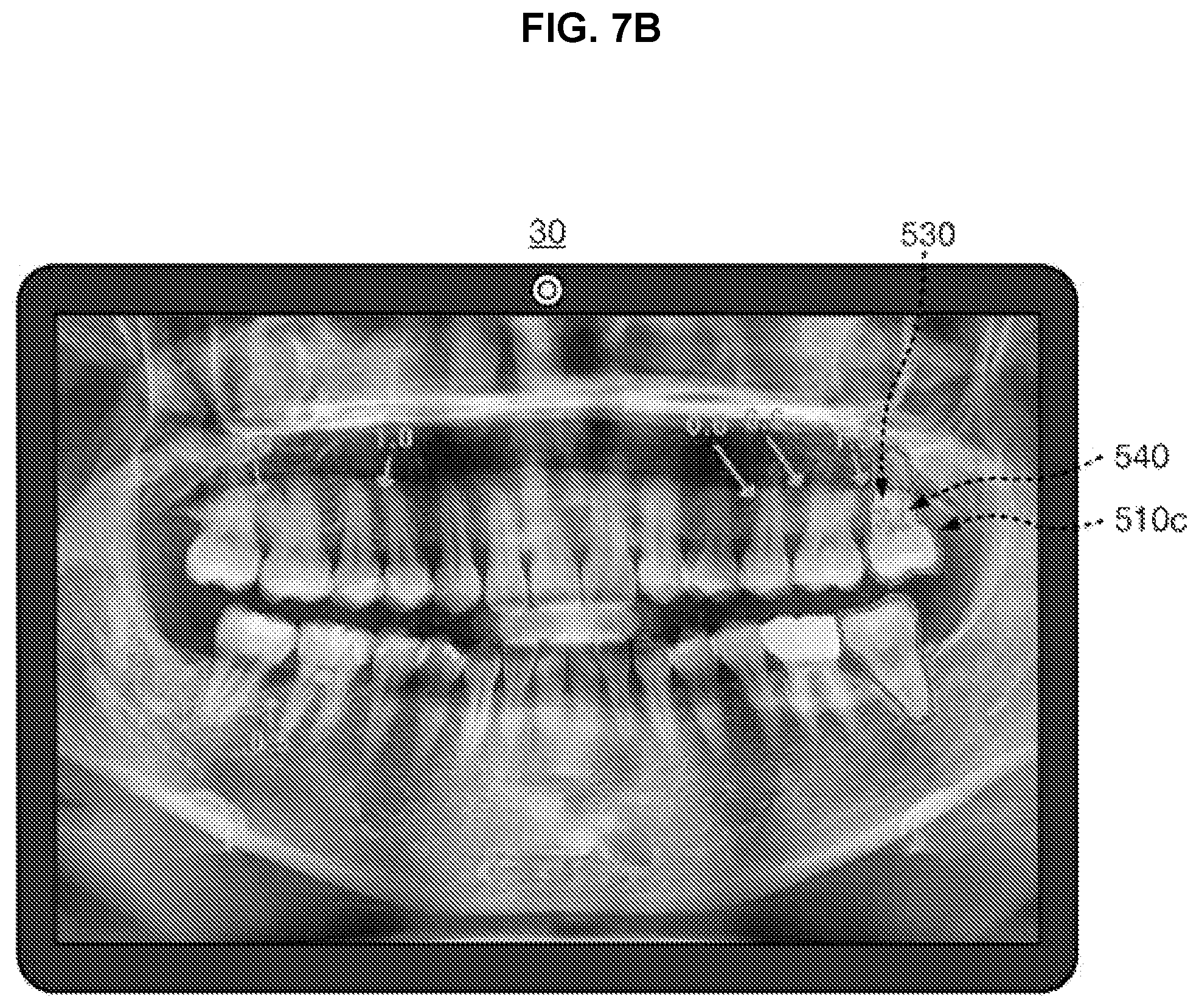 Patent US12567499 Figure 11 – Method and terminal device for providing oral state information including periodontitis