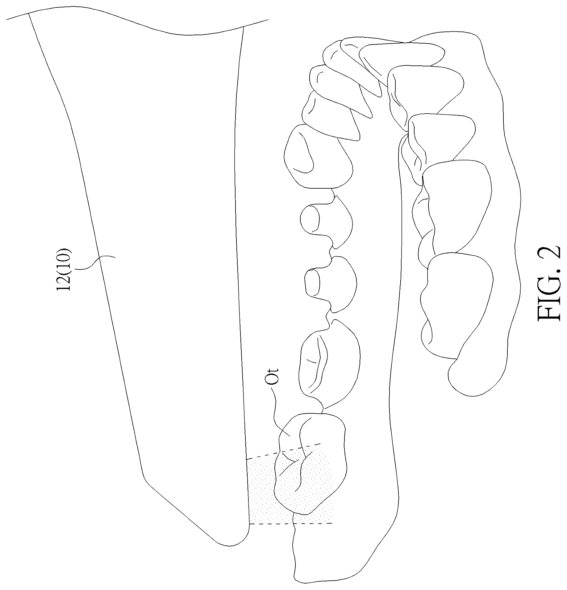 Patent US12568195 Figure 2 – Stereoscopic scanning method, stereoscopic image analysis method and scanning apparatus
