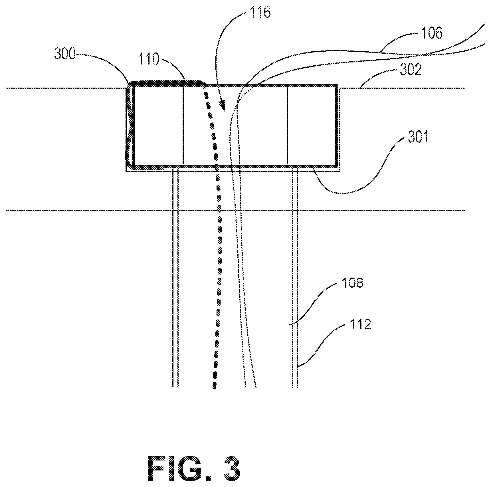 Patent US12568326 Figure 3 – Mechanism for external multi-functional cable retention for a hearing device