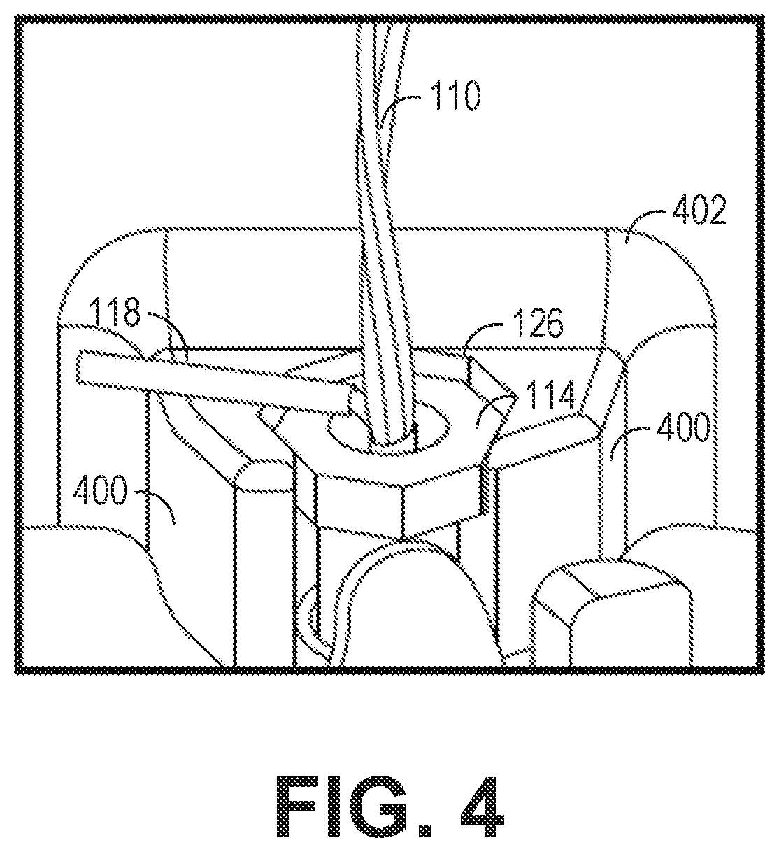 Patent US12568326 Figure 4 – Mechanism for external multi-functional cable retention for a hearing device