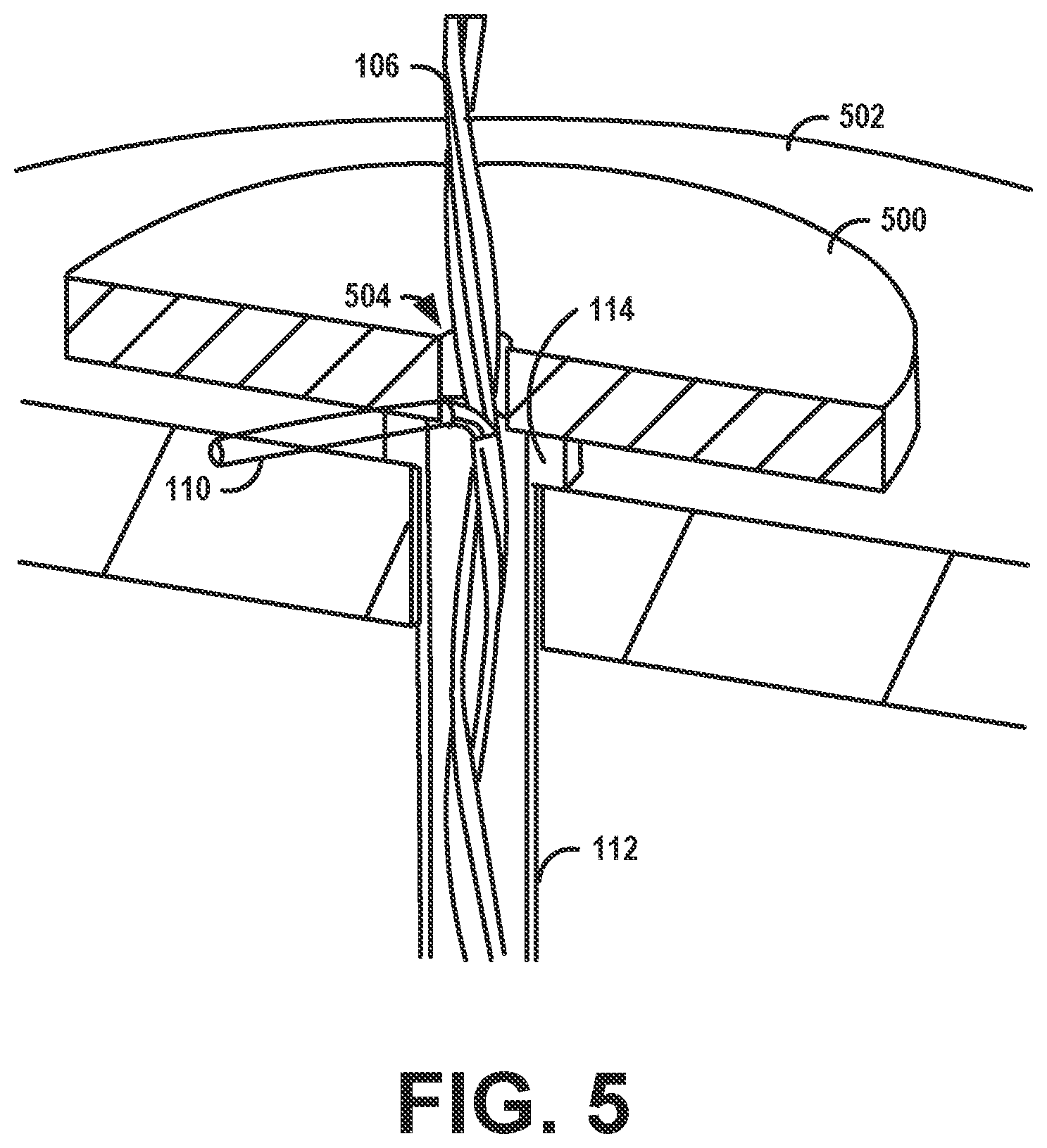 Patent US12568326 Figure 5 – Mechanism for external multi-functional cable retention for a hearing device