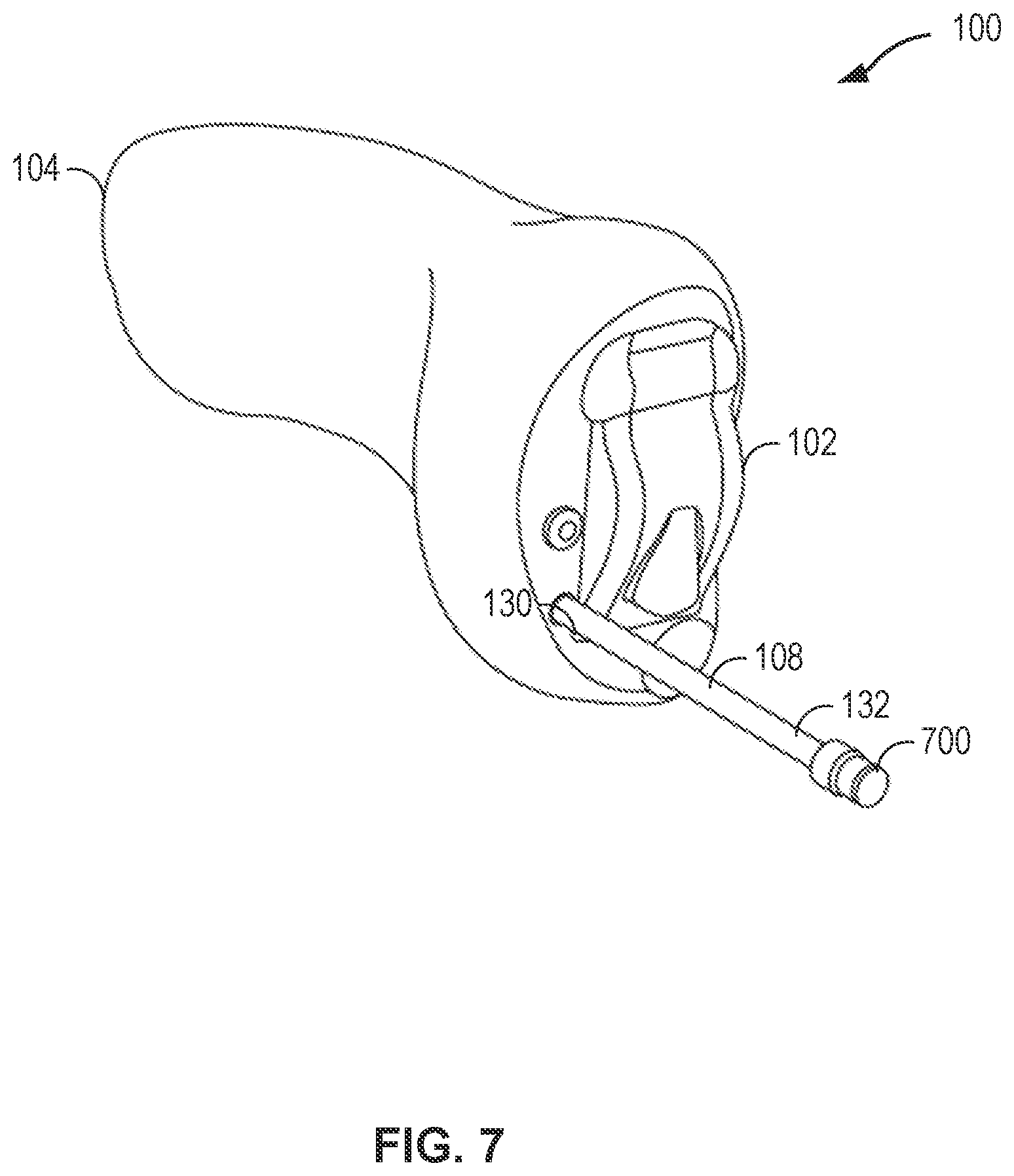 Patent US12568326 Figure 7 – Mechanism for external multi-functional cable retention for a hearing device