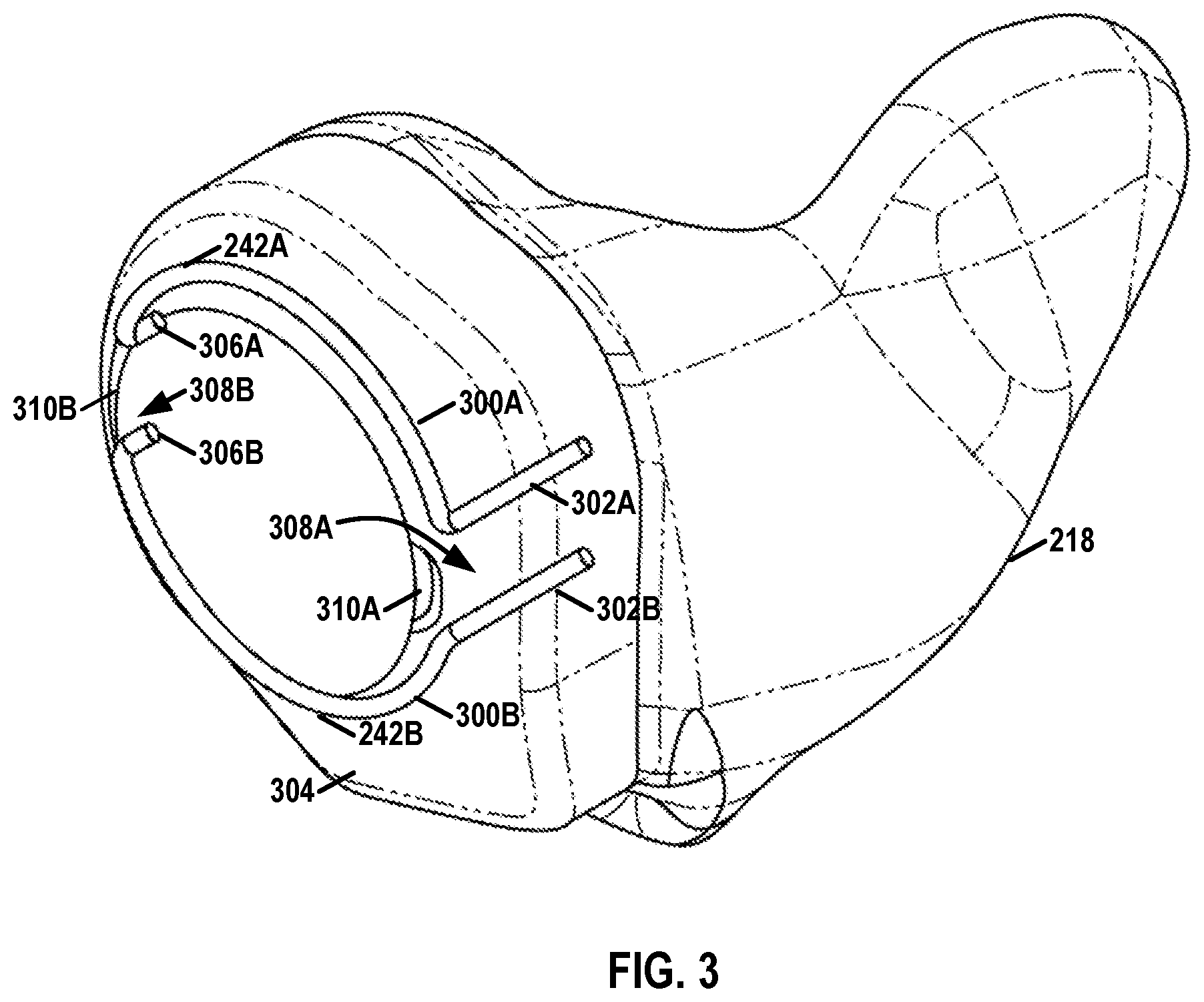 Patent US12568339 Figure 3 – Curved acoustic path for hearing instruments