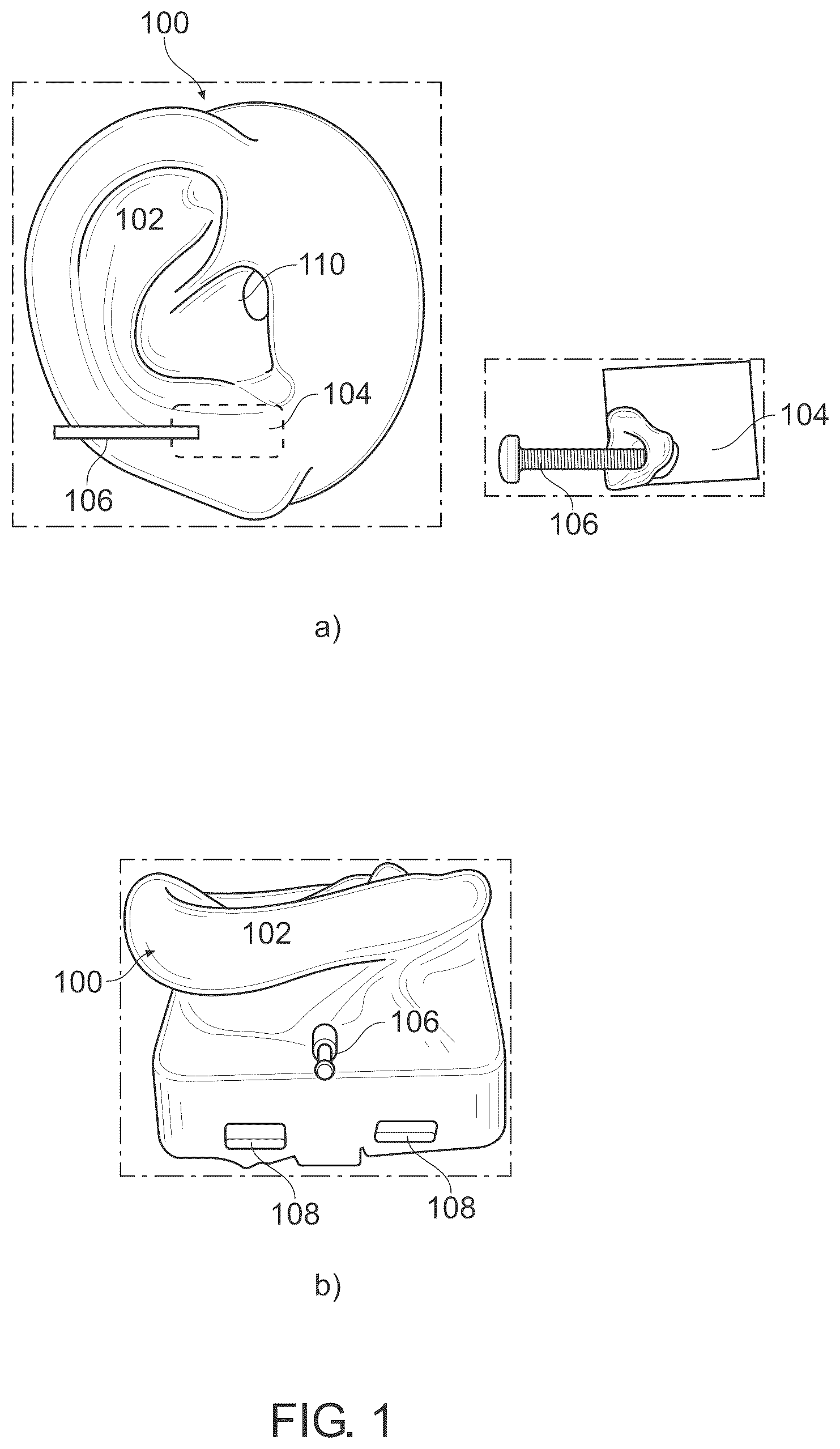 Patent US12568340 Figure 1 – Ear model unit for electroacoustic testing and a method for performing electroacoustic testing of a hearing device