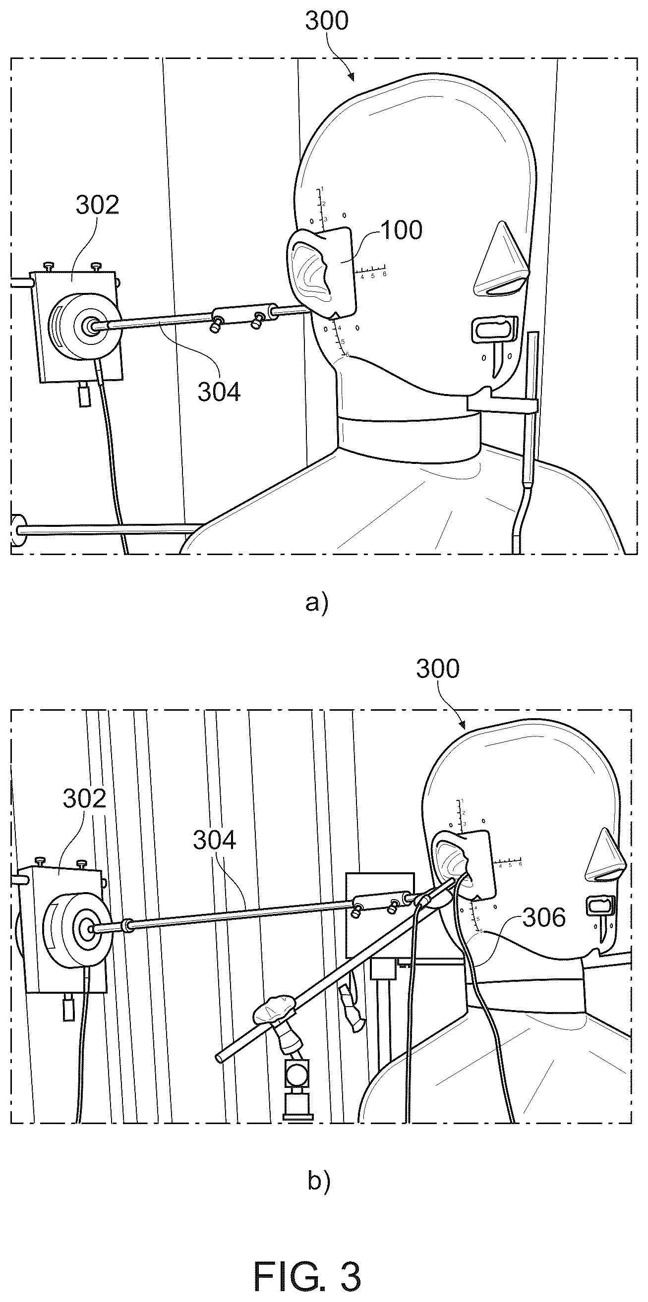 Patent US12568340 Figure 4 – Ear model unit for electroacoustic testing and a method for performing electroacoustic testing of a hearing device
