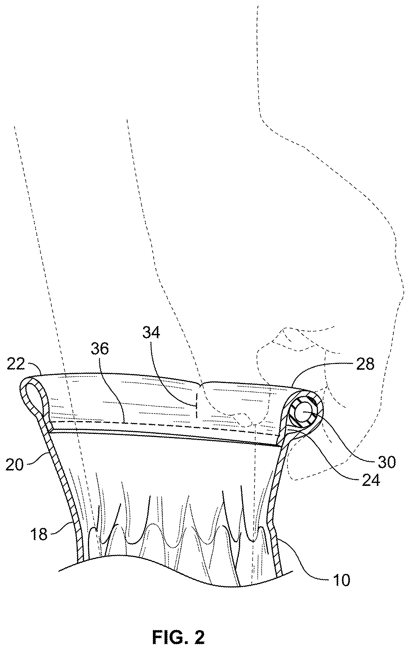 Patent US12569019 Figure 2 – Glove construction