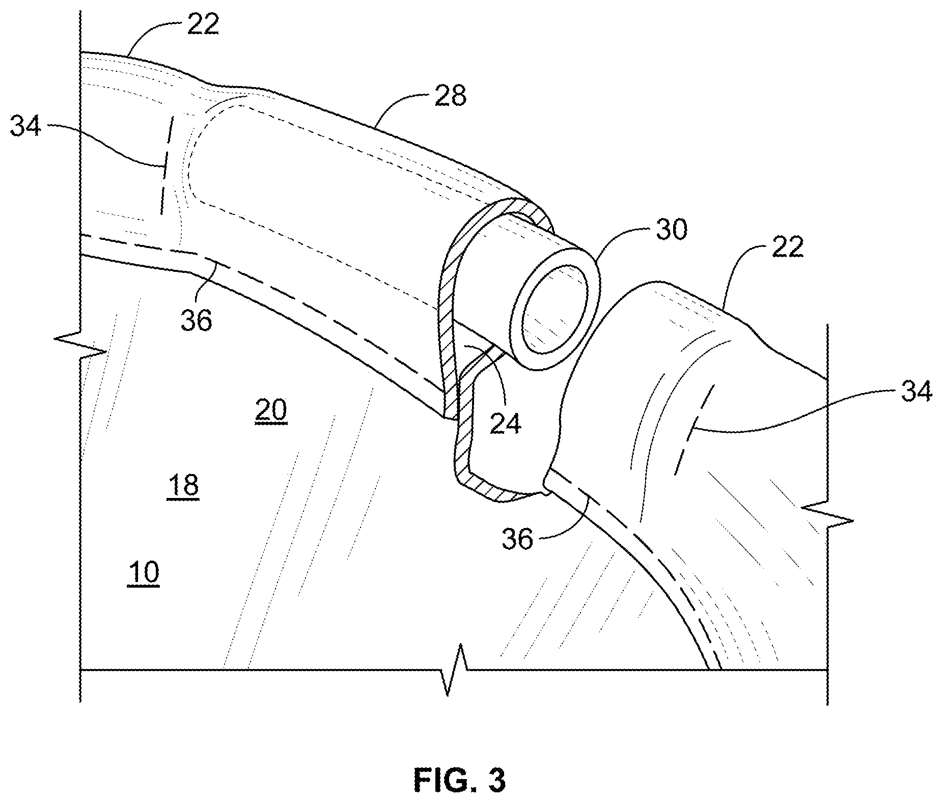 Patent US12569019 Figure 3 – Glove construction