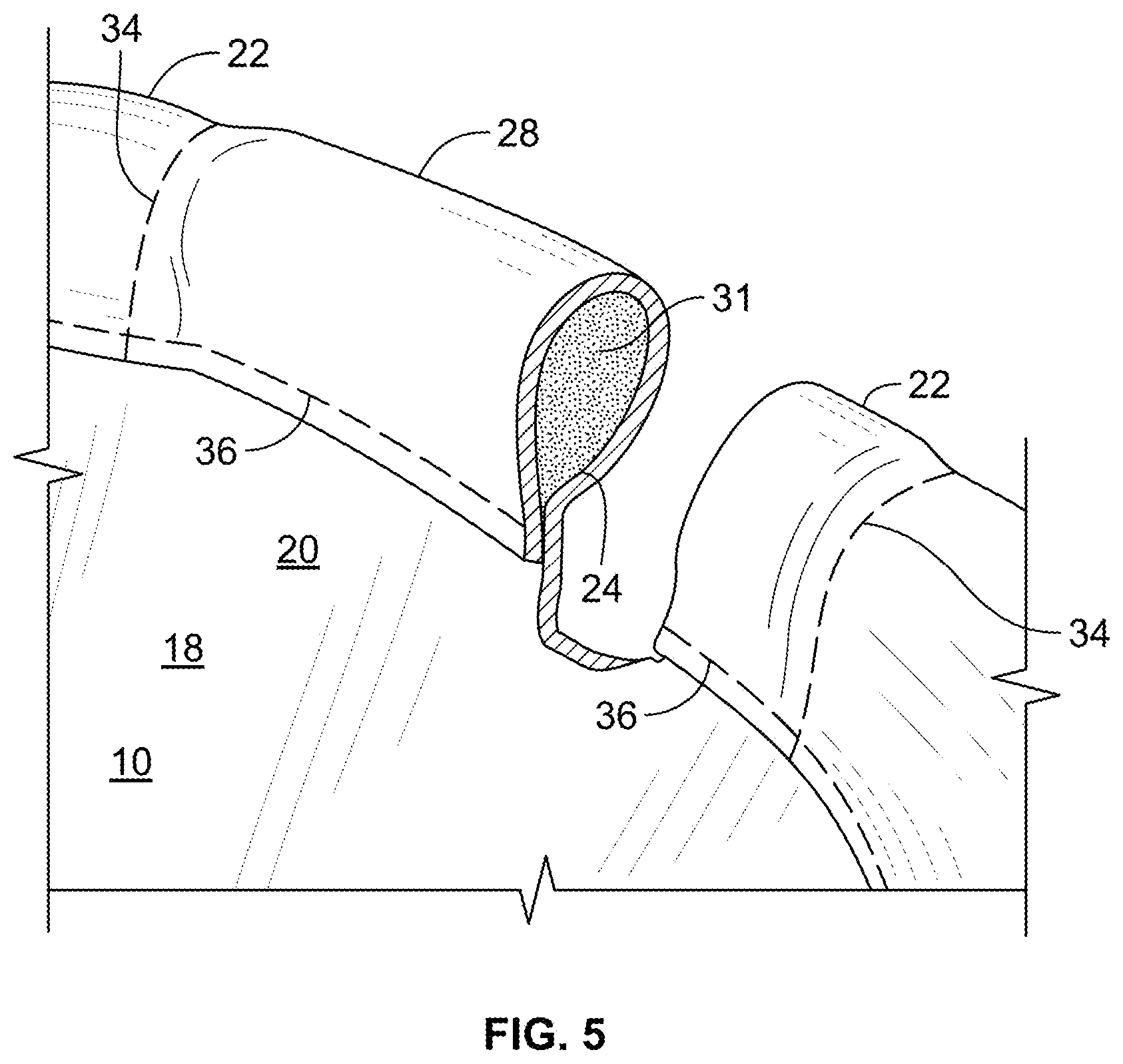 Patent US12569019 Figure 5 – Glove construction