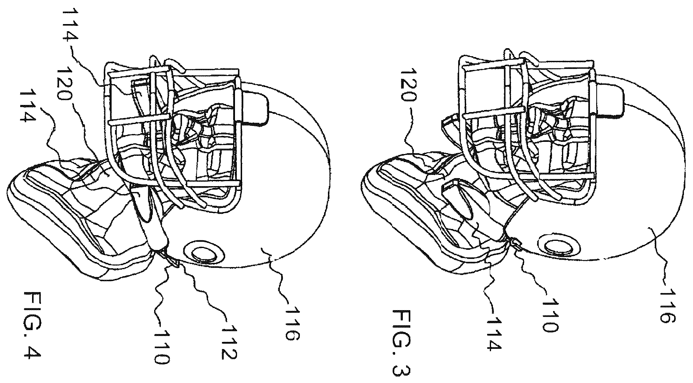 Patent US12569021 Figure 2 – Apparatus for minimizing the effects of impact forces to the skull