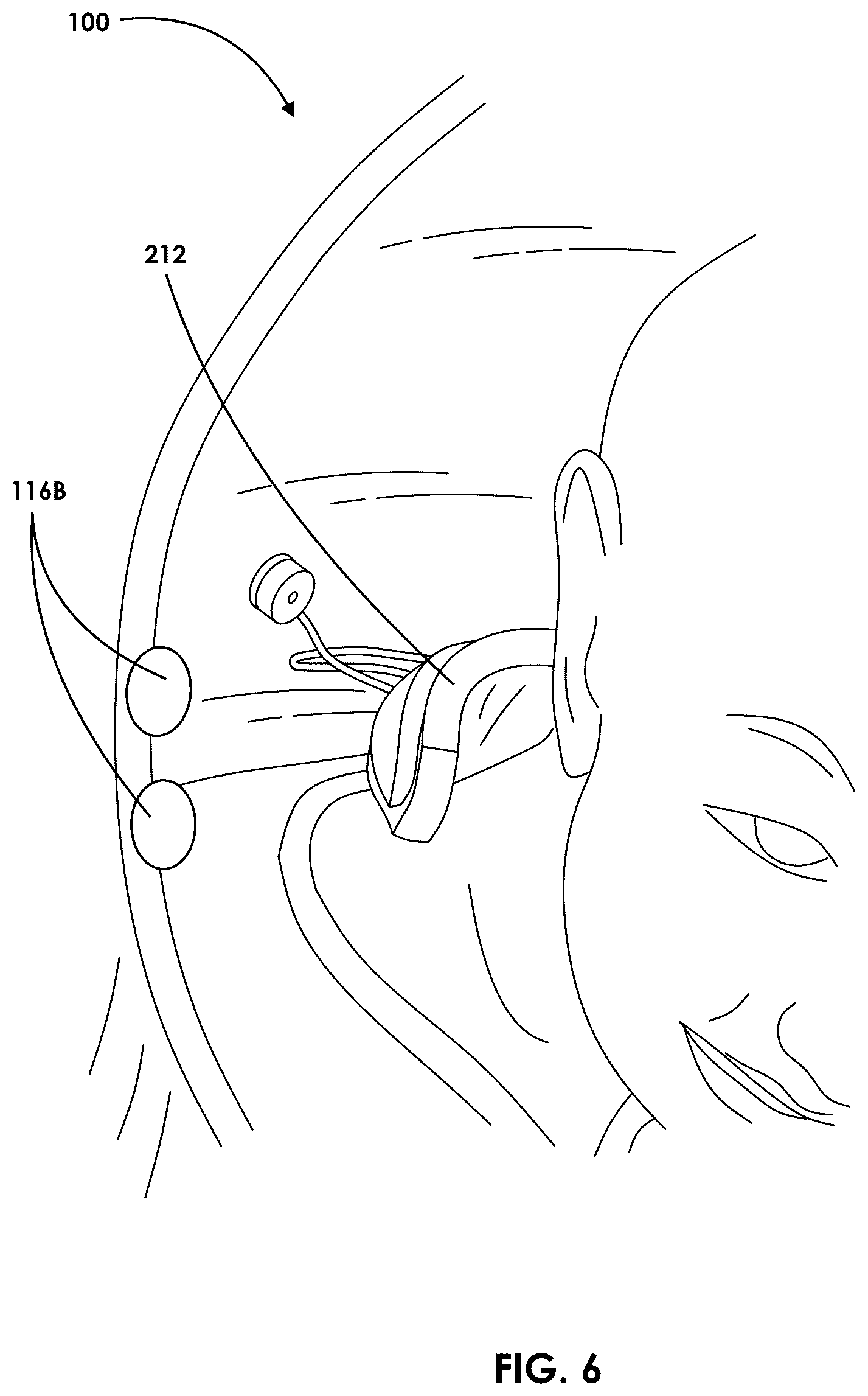 Patent US12569024 Figure 6 – Impact protection suit