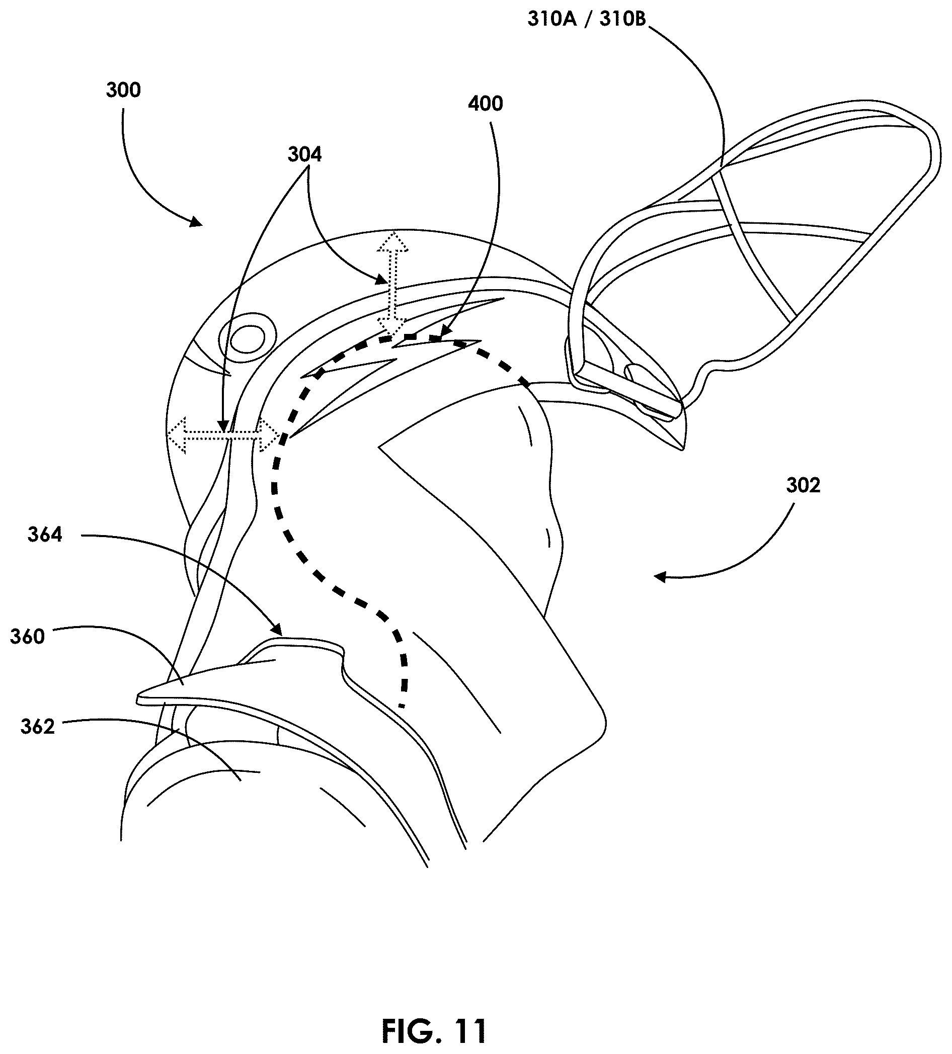 Patent US12569024 Figure 11 – Impact protection suit