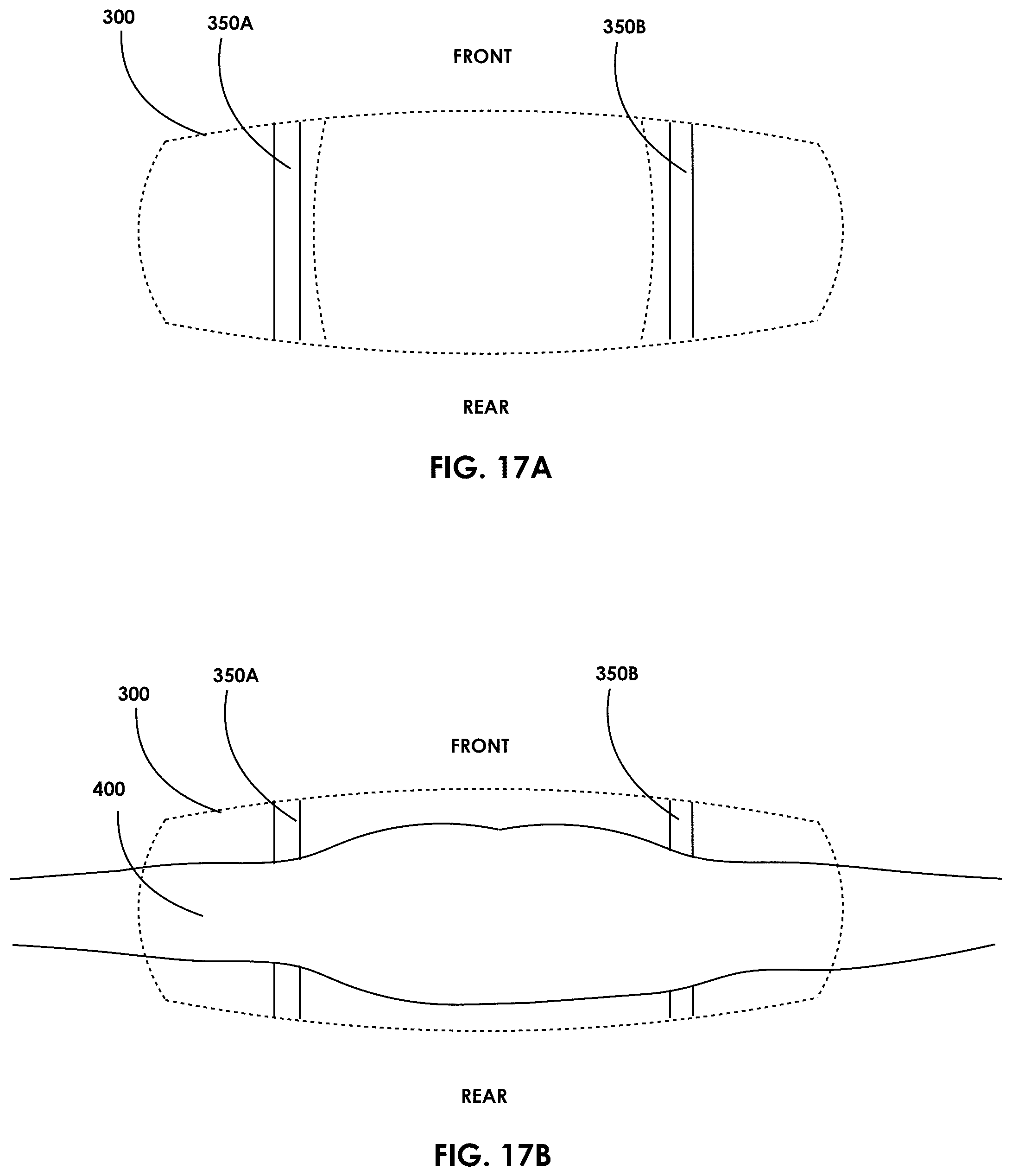 Patent US12569024 Figure 17 – Impact protection suit