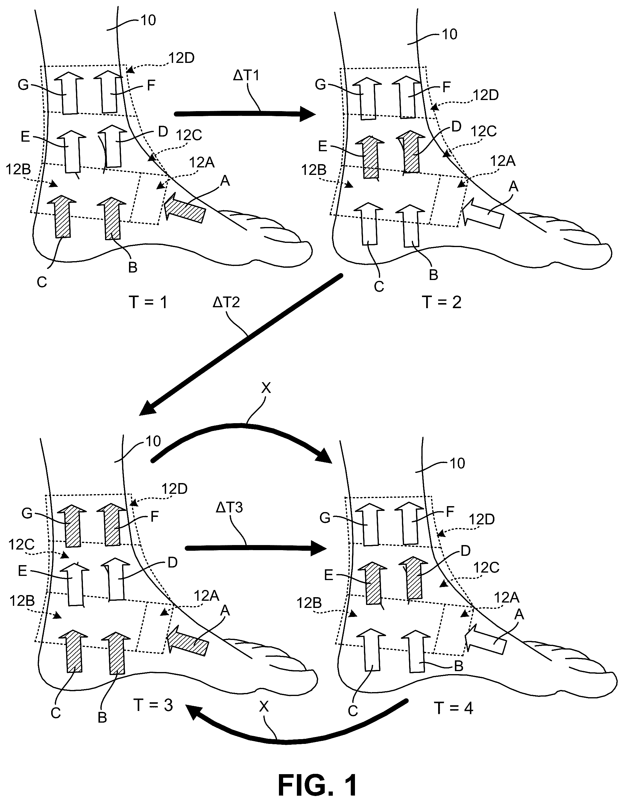 Patent US12569025 — Footwear structures providing compression and thermal treatment — Figure 1