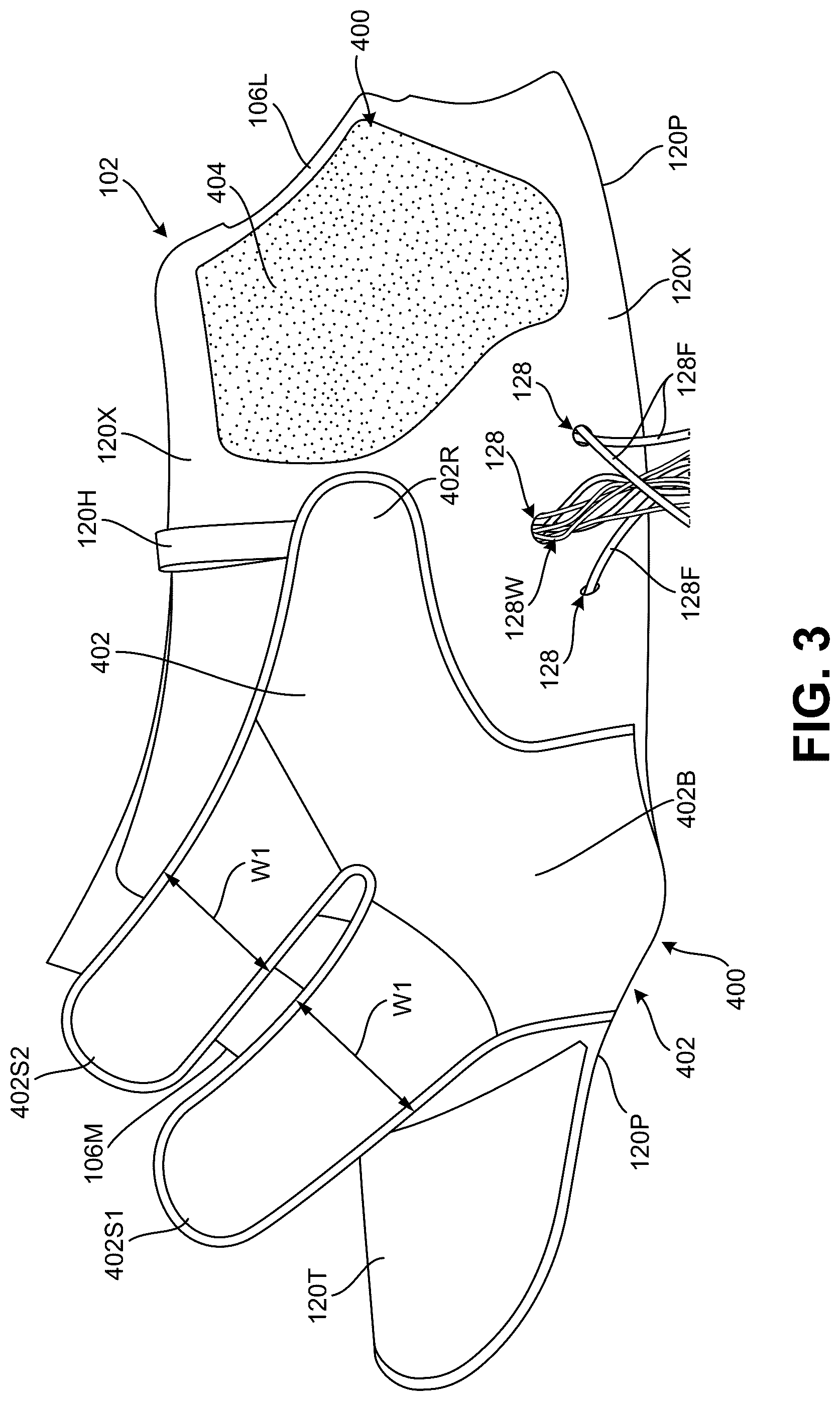 Patent US12569025 Figure 6 – Footwear structures providing compression and thermal treatment