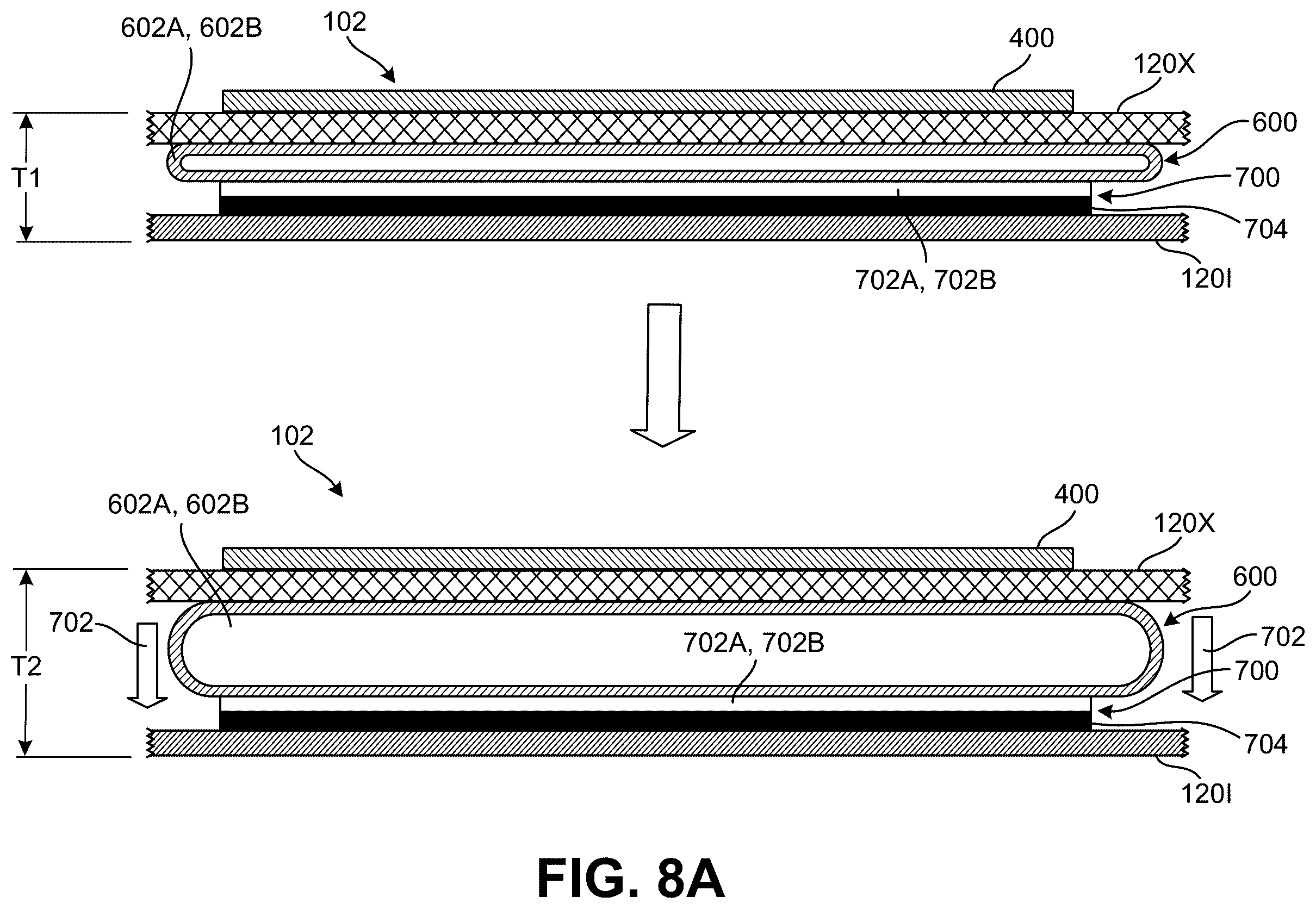 Patent US12569025 Figure 12 – Footwear structures providing compression and thermal treatment