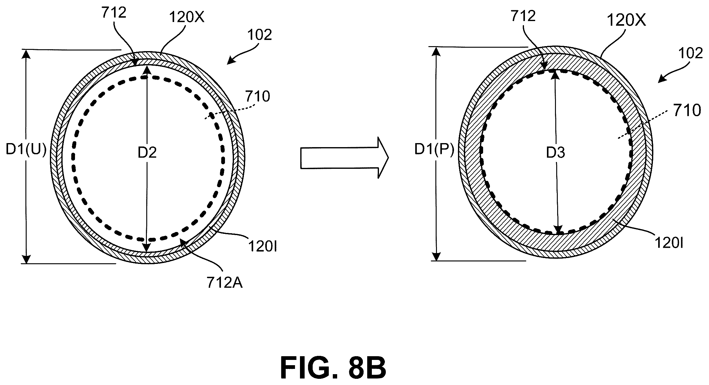 Patent US12569025 Figure 13 – Footwear structures providing compression and thermal treatment