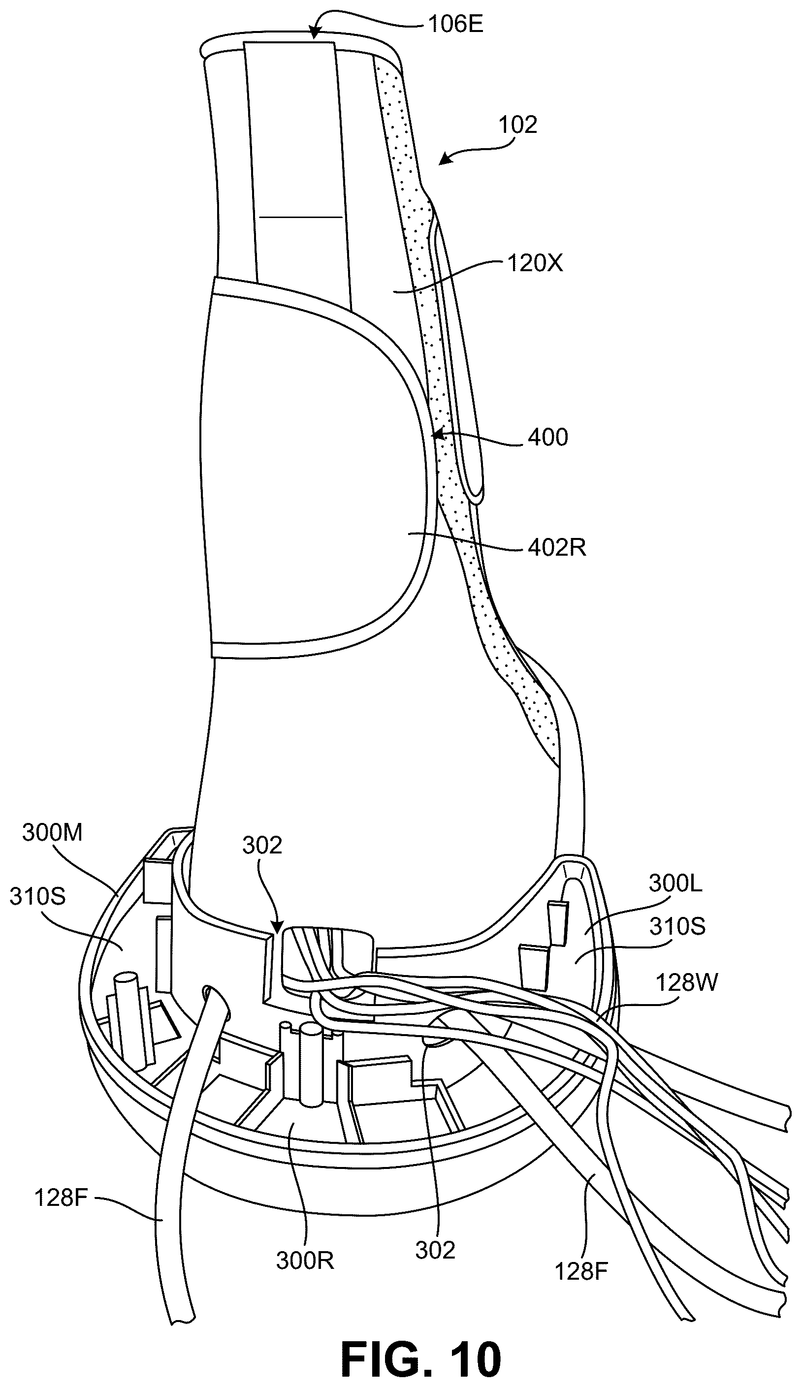 Patent US12569025 Figure 17 – Footwear structures providing compression and thermal treatment