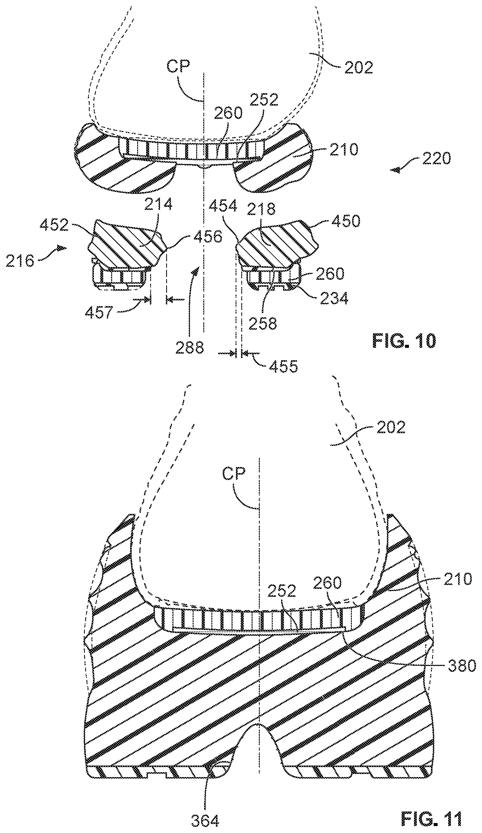 Patent US12569031 Figure 8 – Sole structure for an article of footwear