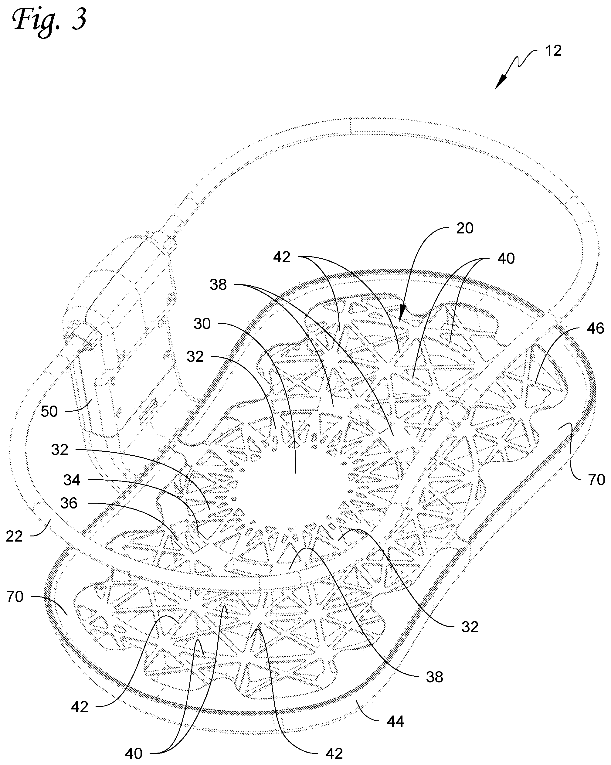 Patent US12569074 Figure 3 – Infant sleep device