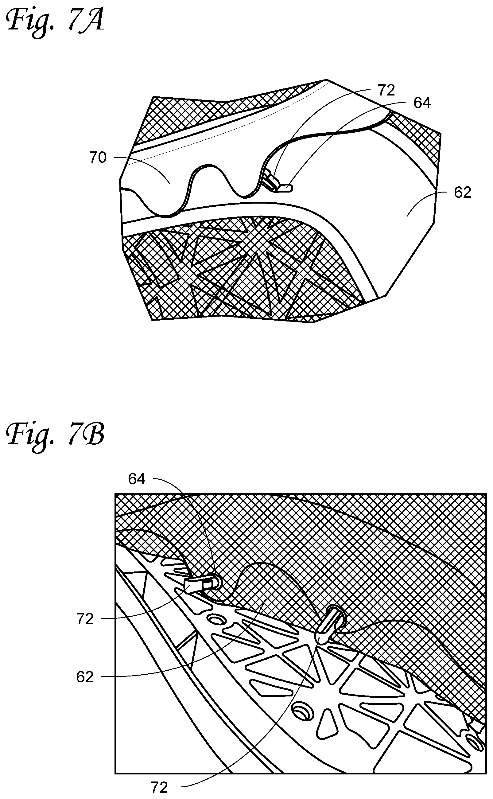 Patent US12569074 Figure 7 – Infant sleep device