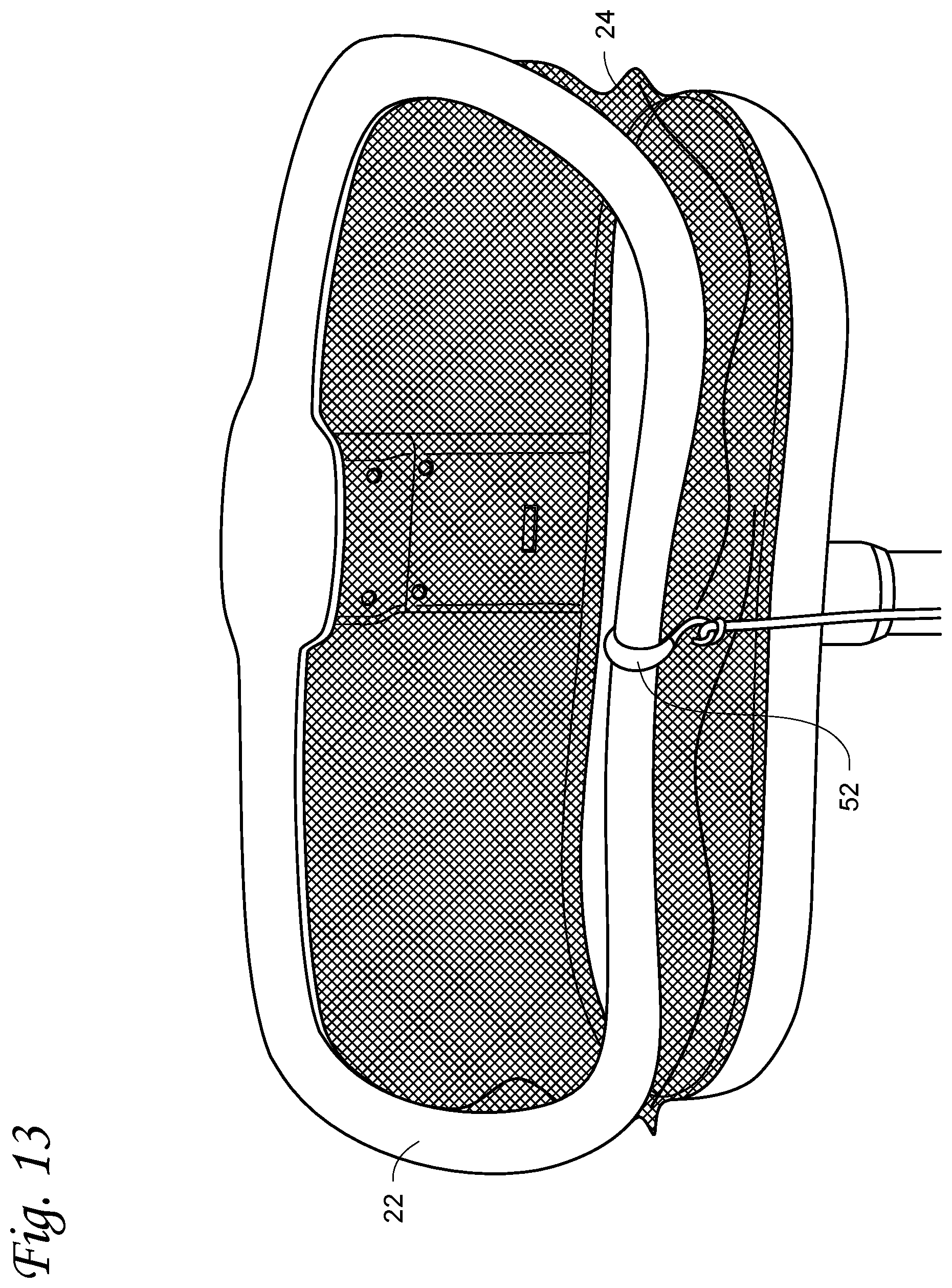 Patent US12569074 Figure 17 – Infant sleep device