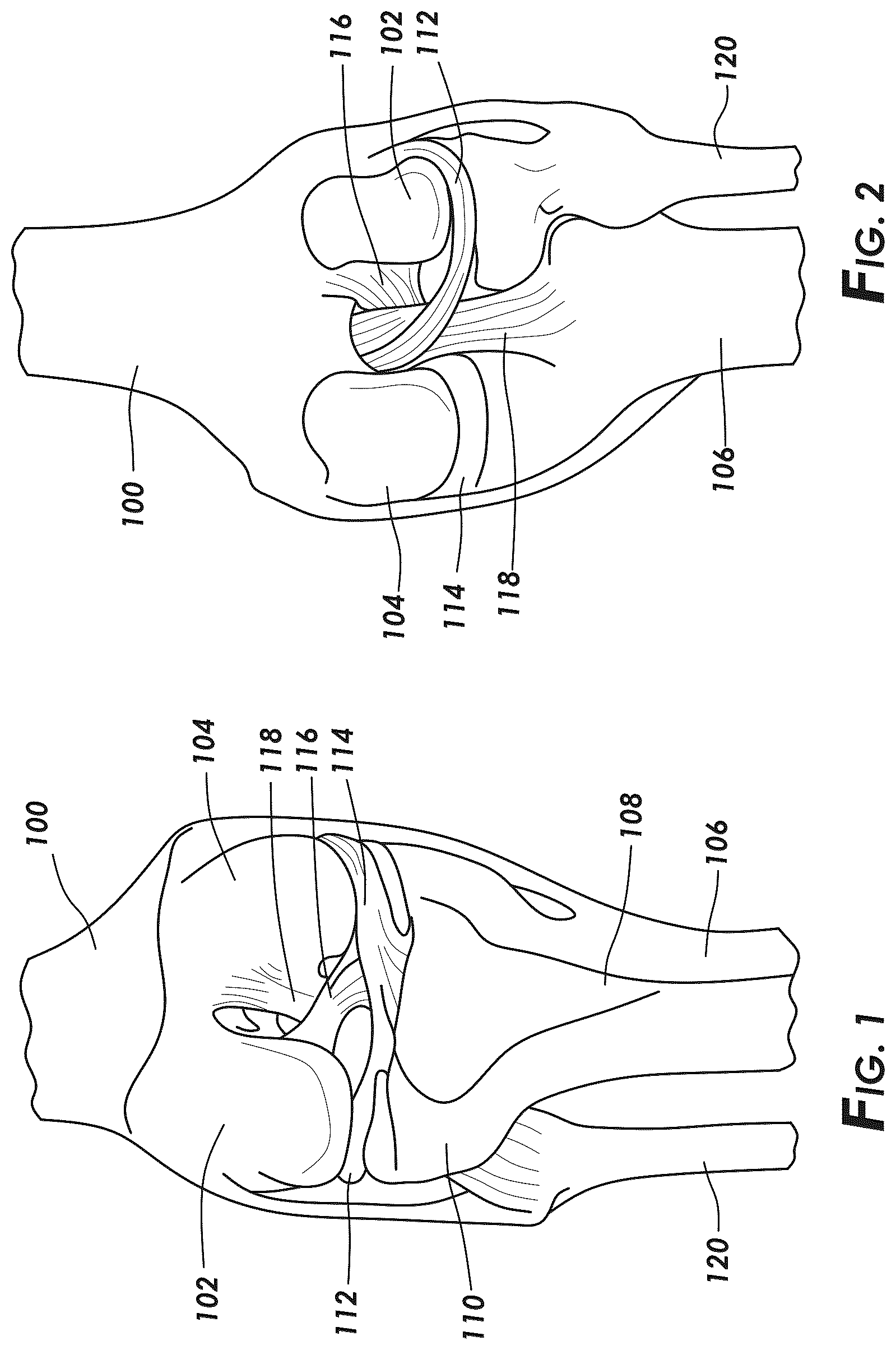 Patent US12569114 Figure 1 – Methods and systems for intraoperatively selecting and displaying cross-sectional images