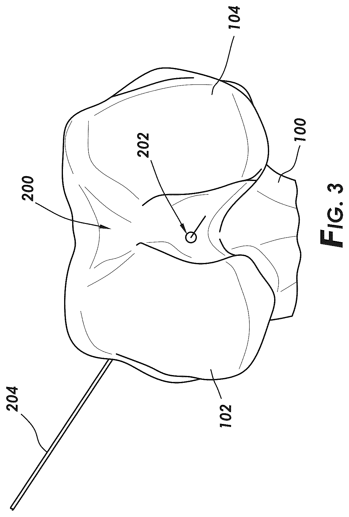 Patent US12569114 Figure 2 – Methods and systems for intraoperatively selecting and displaying cross-sectional images