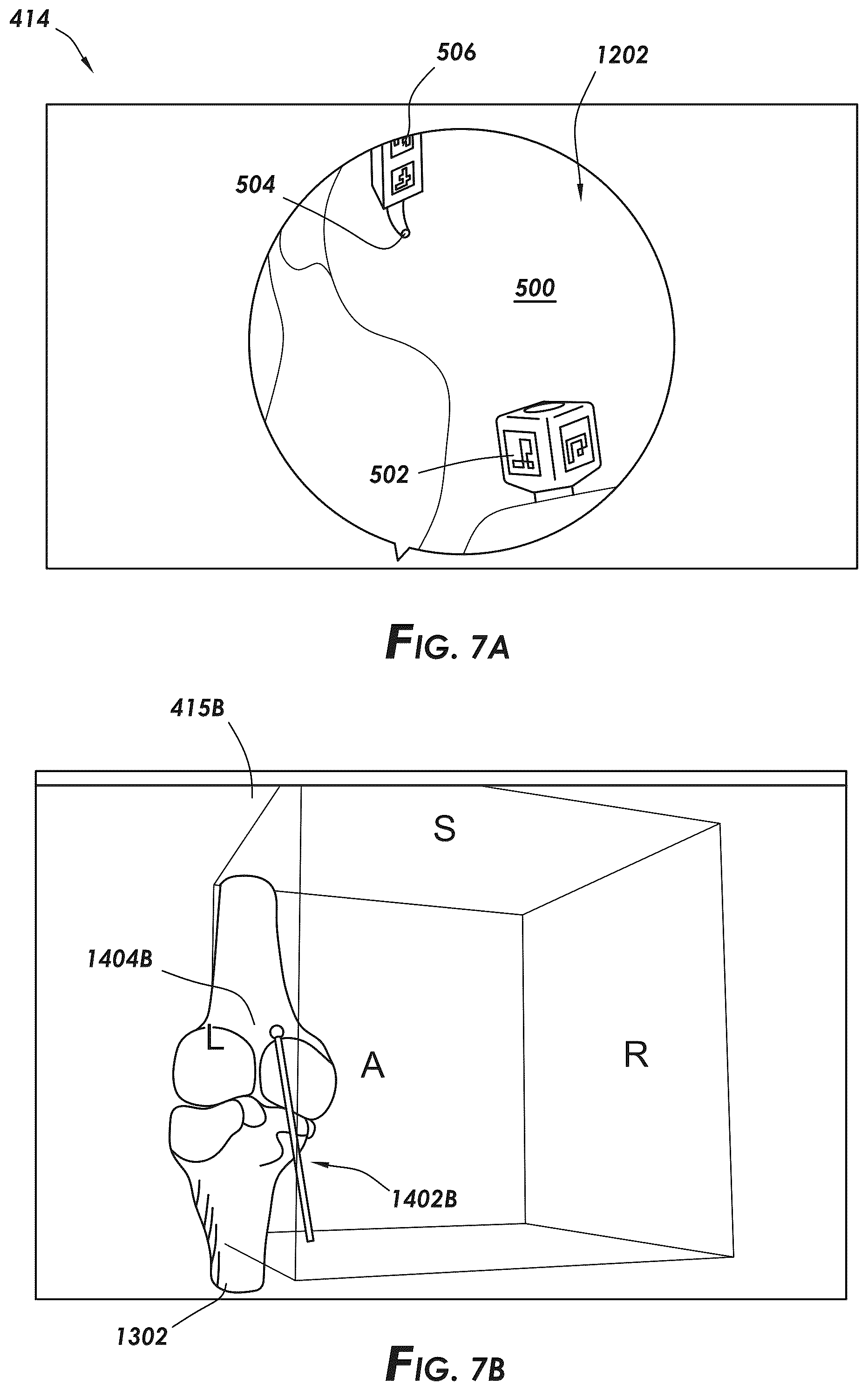 Patent US12569114 Figure 6 – Methods and systems for intraoperatively selecting and displaying cross-sectional images