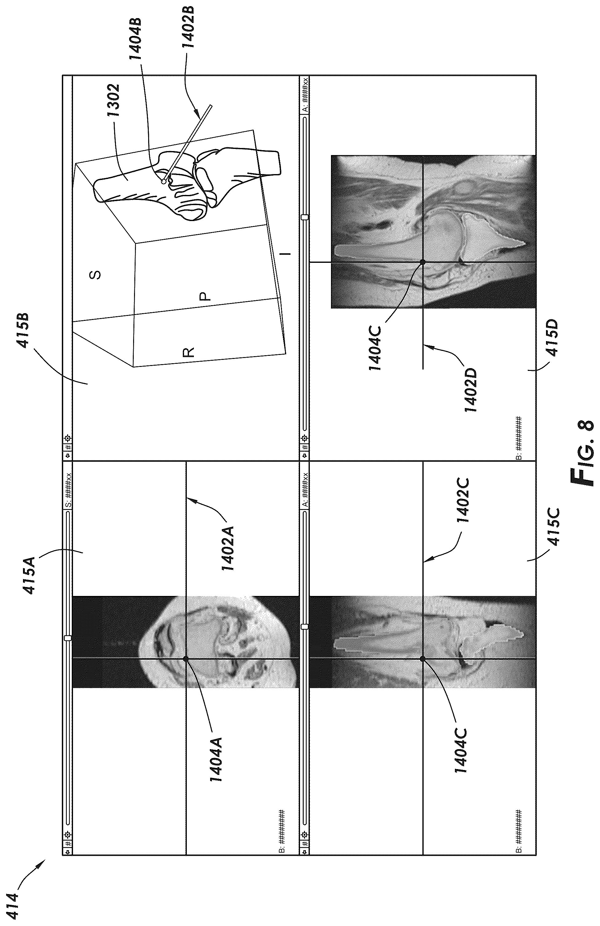 Patent US12569114 Figure 7 – Methods and systems for intraoperatively selecting and displaying cross-sectional images