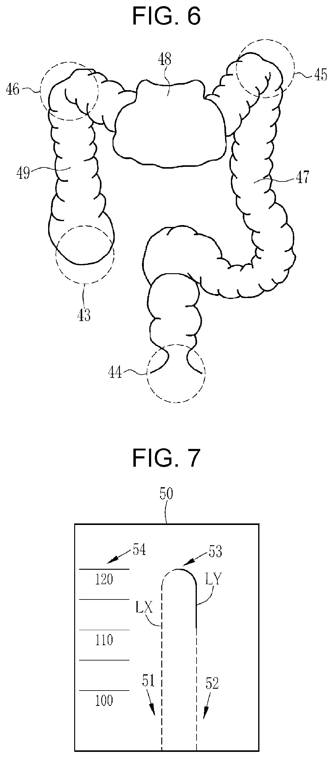 Patent US12569116 Figure 3 – Processor device, operation method of processor device, non-transitory computer readable medium, and endoscope system for displaying movement trajectory of endoscope