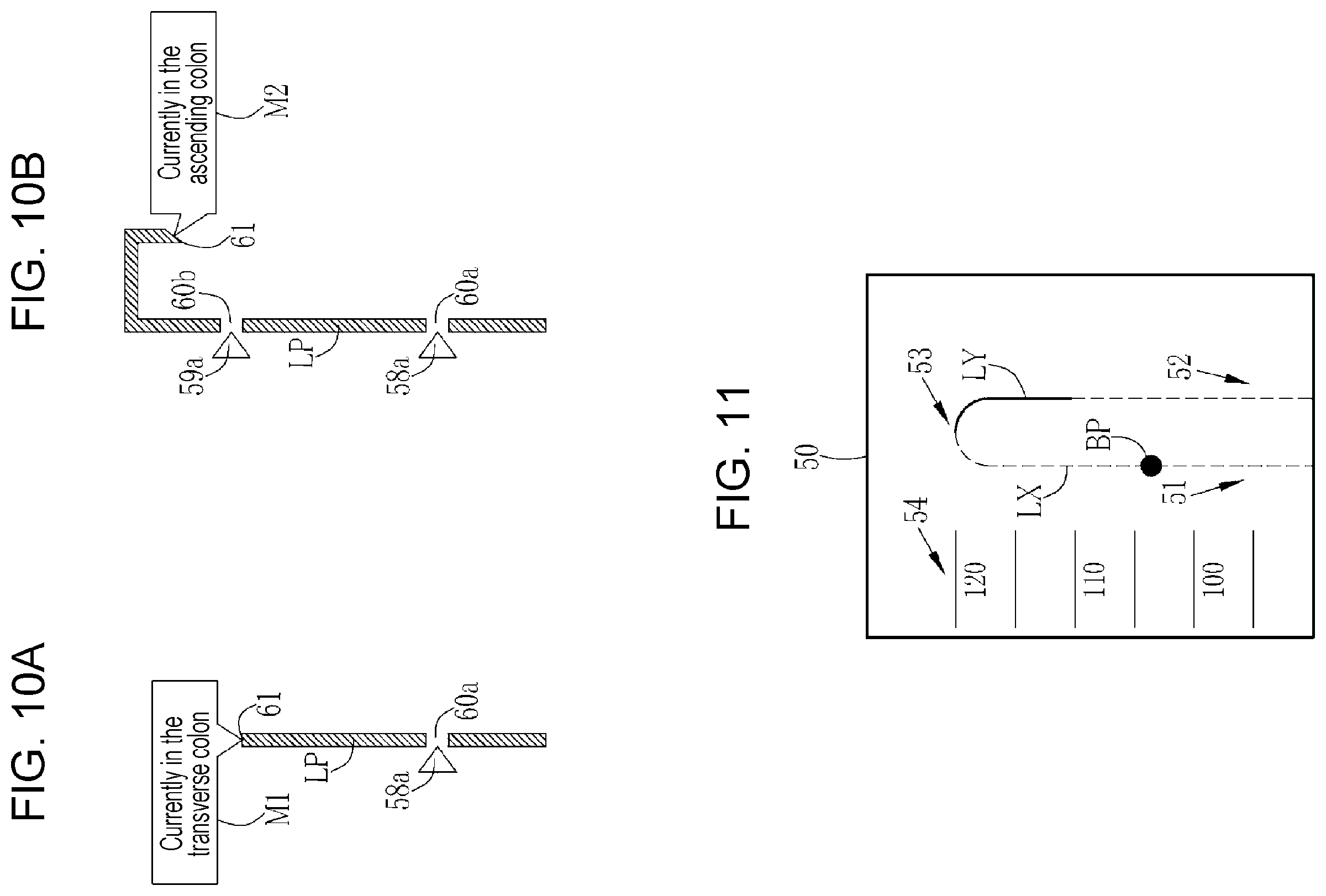 Patent US12569116 Figure 5 – Processor device, operation method of processor device, non-transitory computer readable medium, and endoscope system for displaying movement trajectory of endoscope